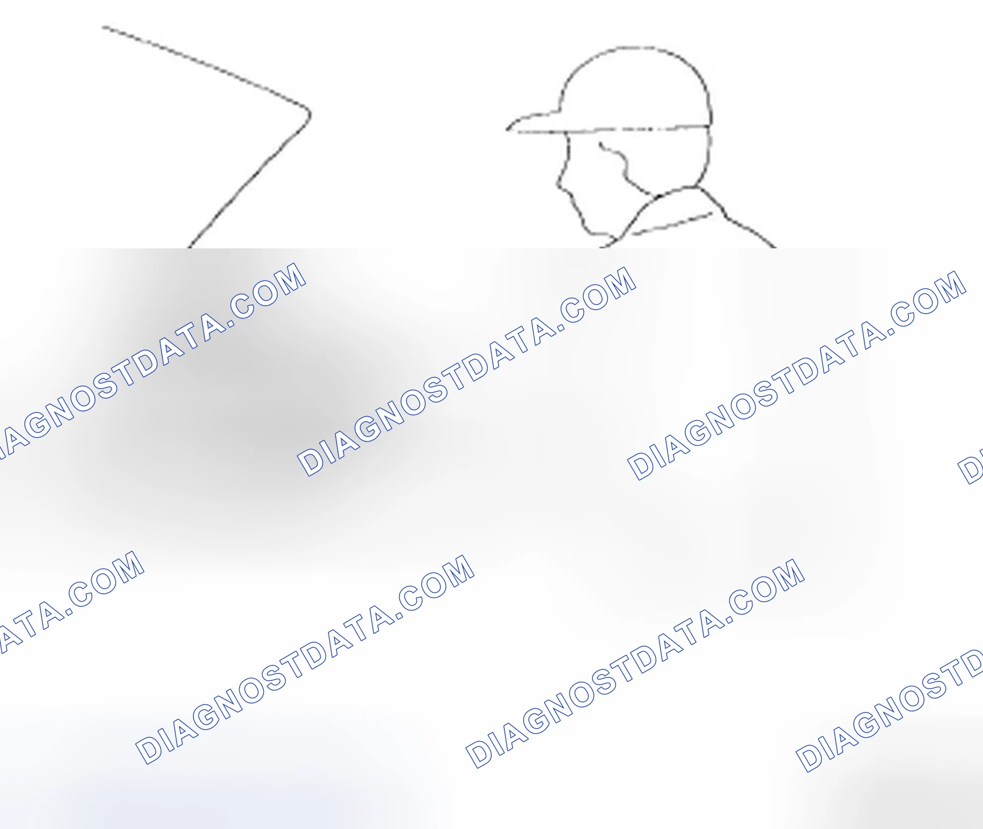 Scheme 5: REMOVAL OF PARTS