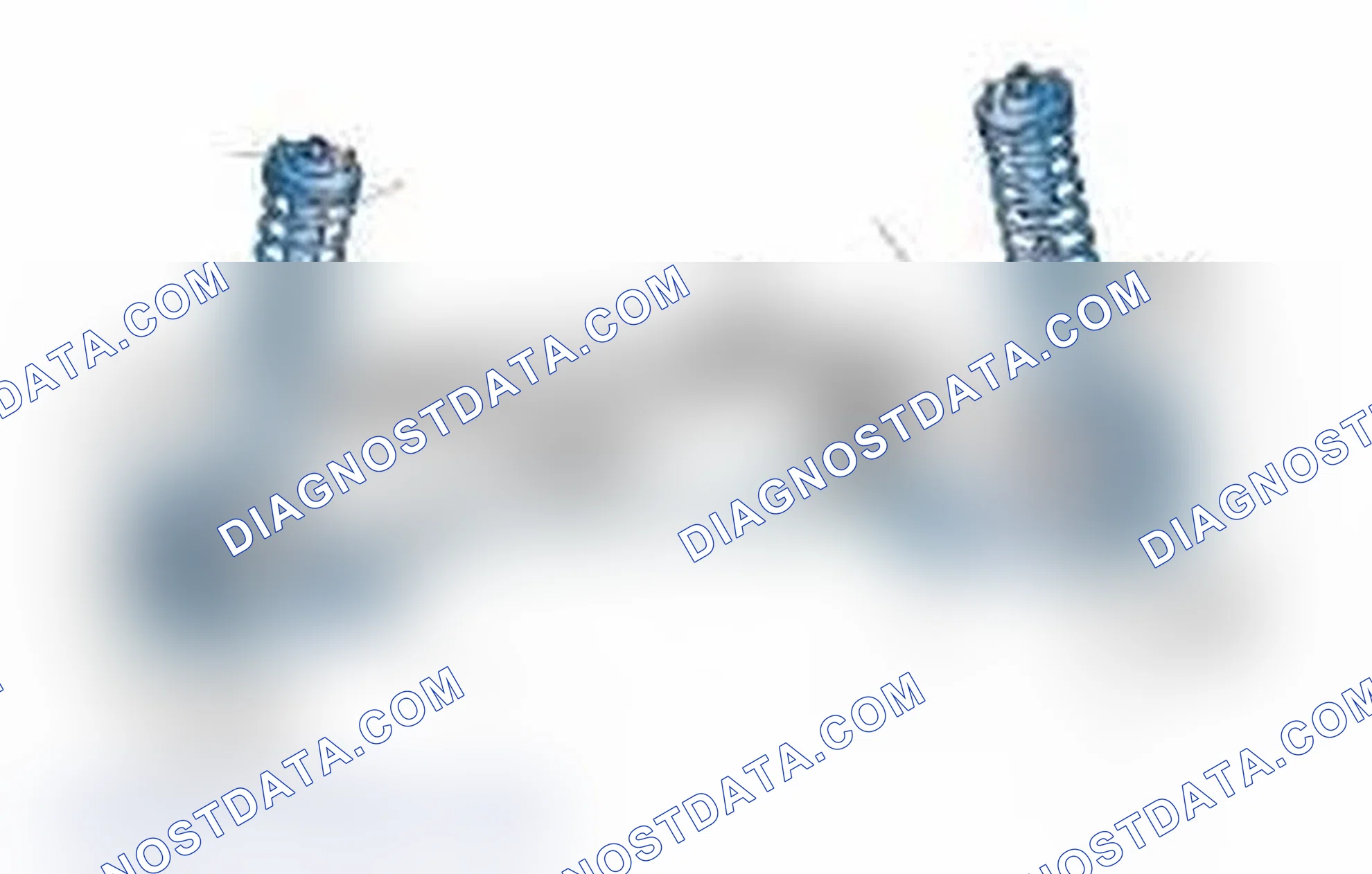 Scheme 25: Typical Front Suspension & Steering Components