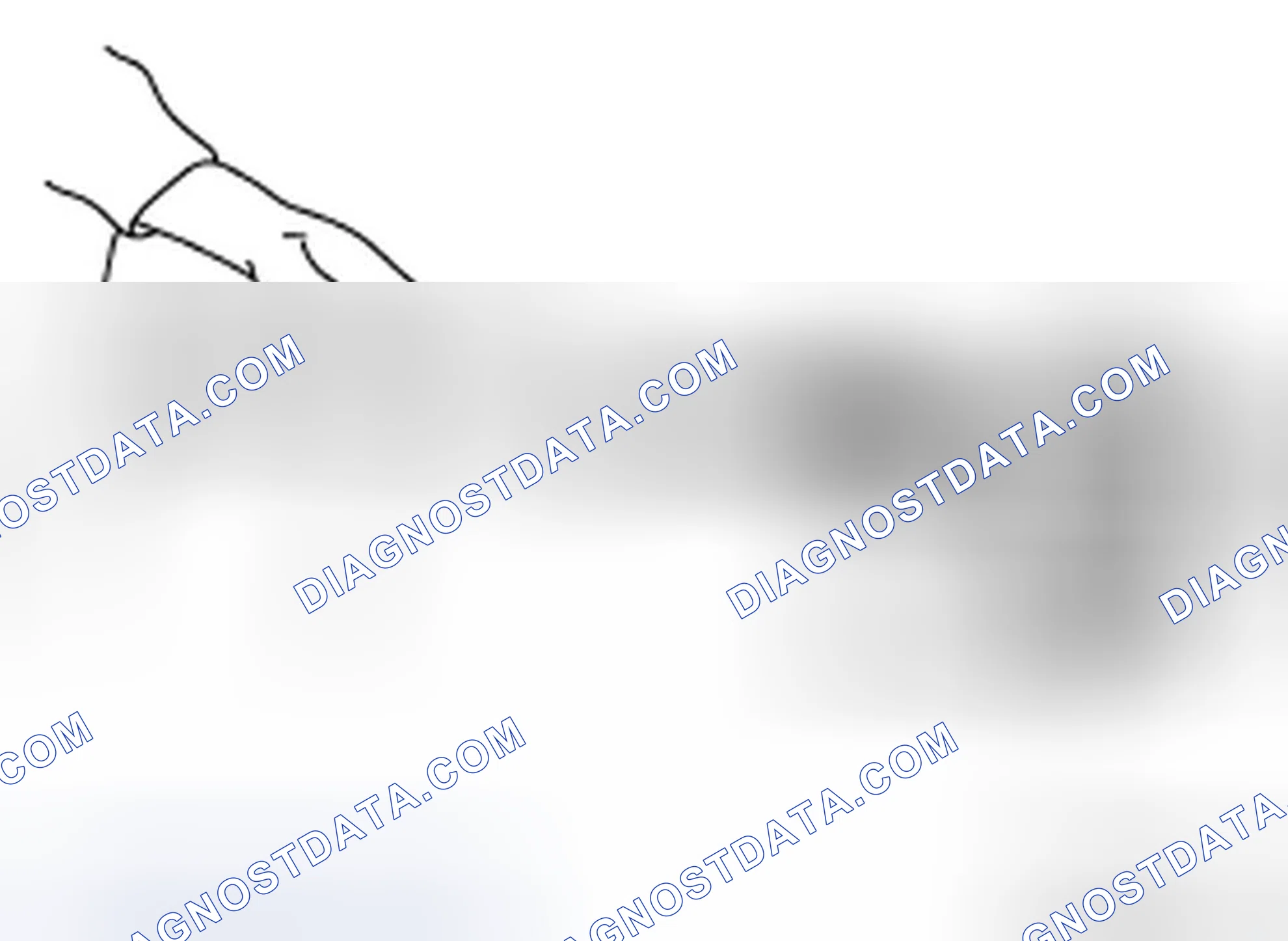 Scheme 38: DISASSEMBLY (WHEEL SIDE)
