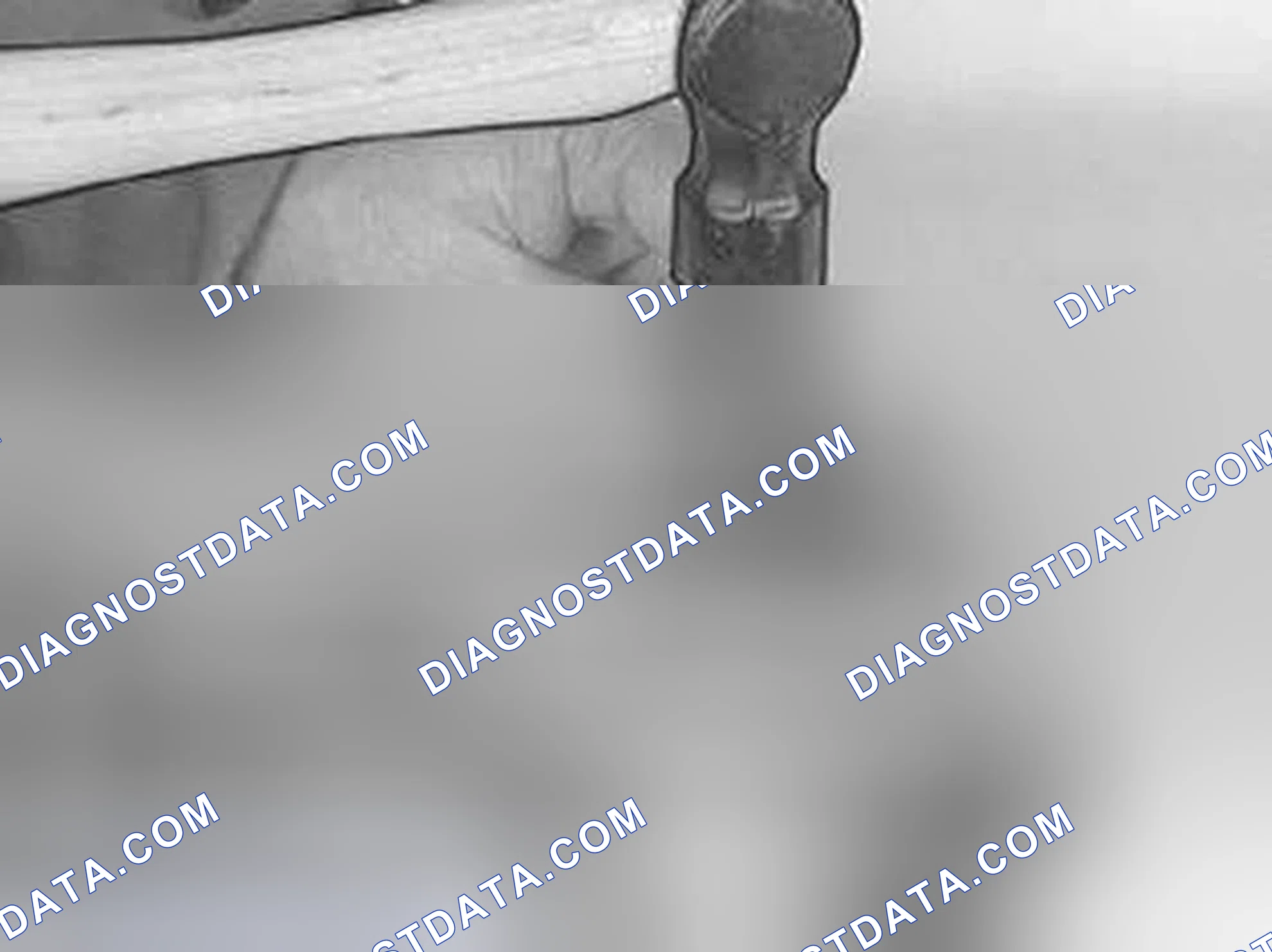 Scheme 461: Marking The Connecting Rod (Where Applicable)