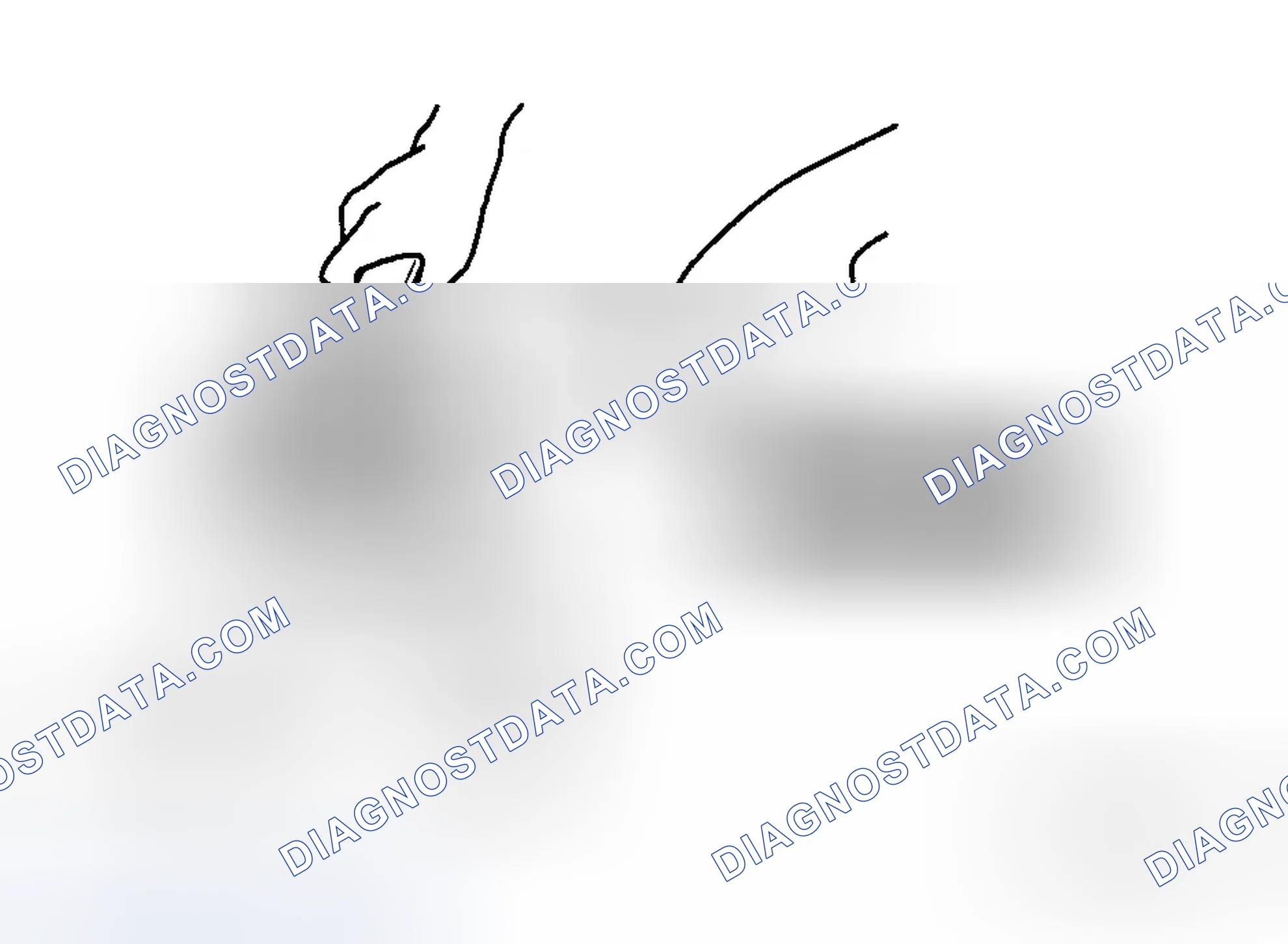 Scheme 36: Locknut Disassembly Note