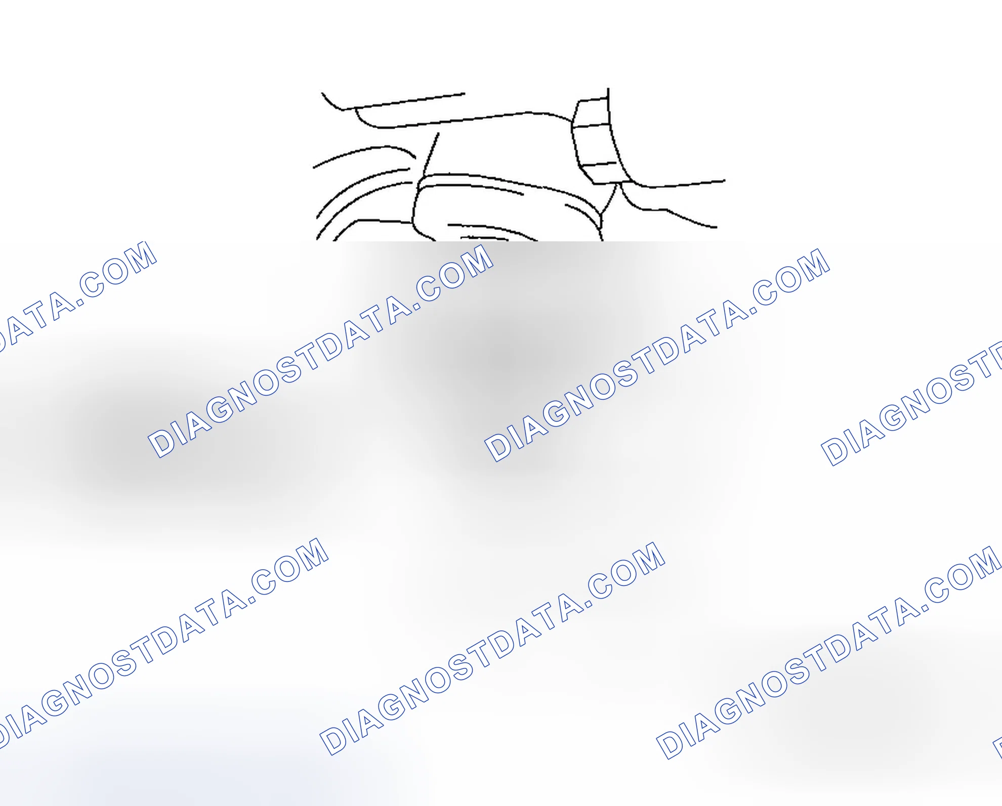 Scheme 17: If steering knuckle bushing is raised during ball joint disconnecting operation