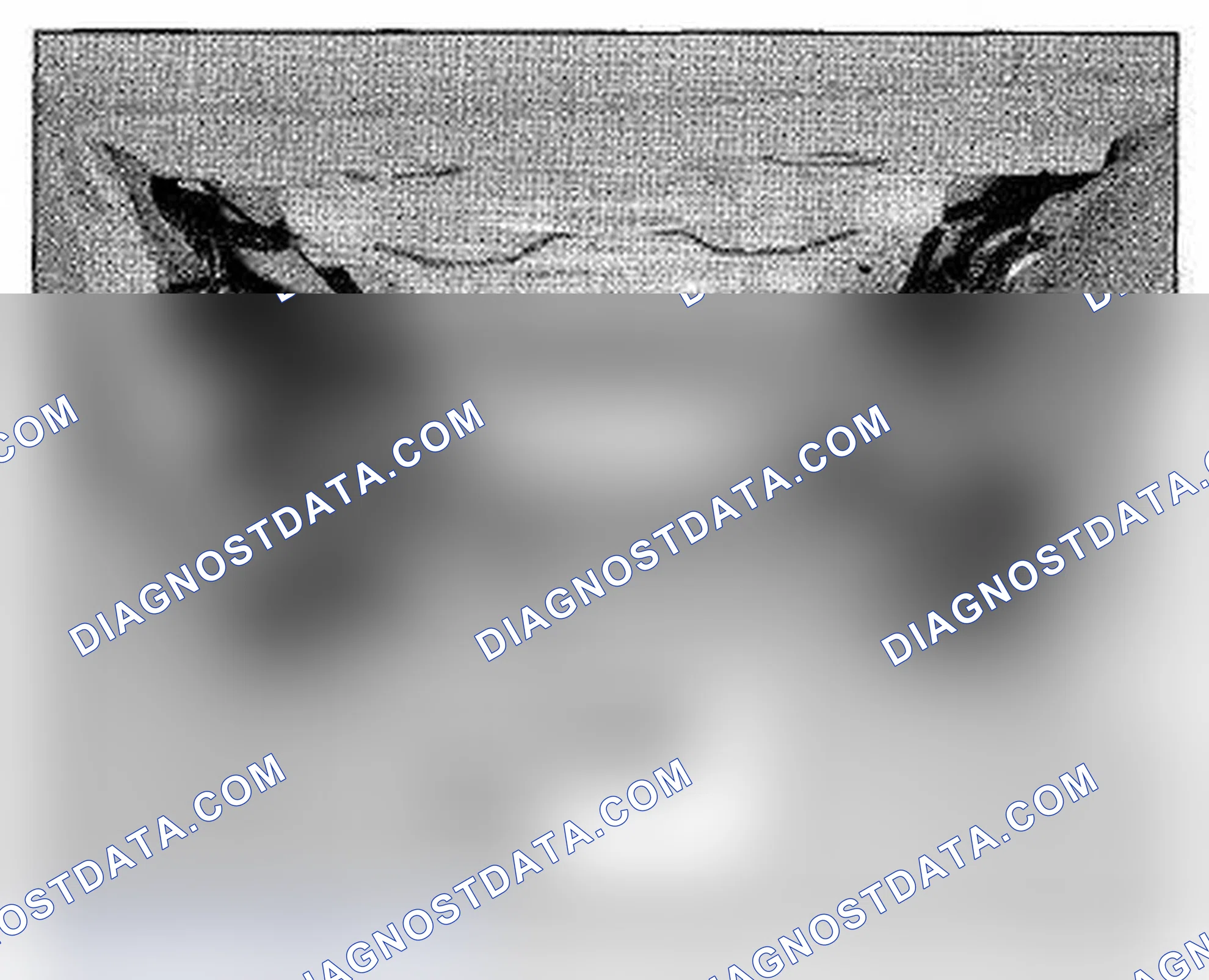 Scheme 1110: Front Passenger's Seat Back Component Location (Photo 101)