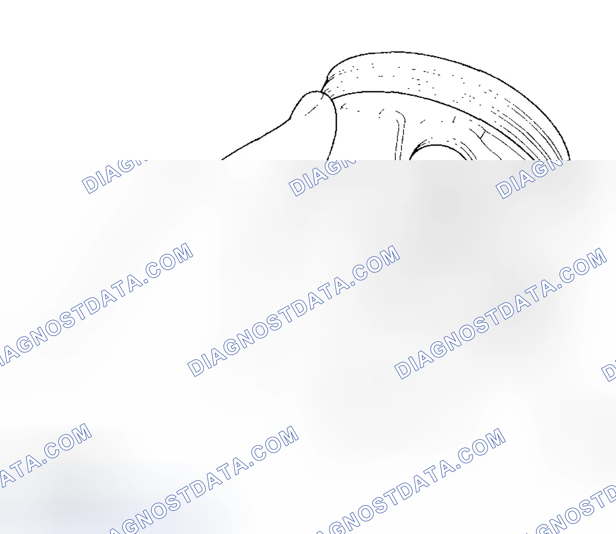 Scheme 356: Reassembly