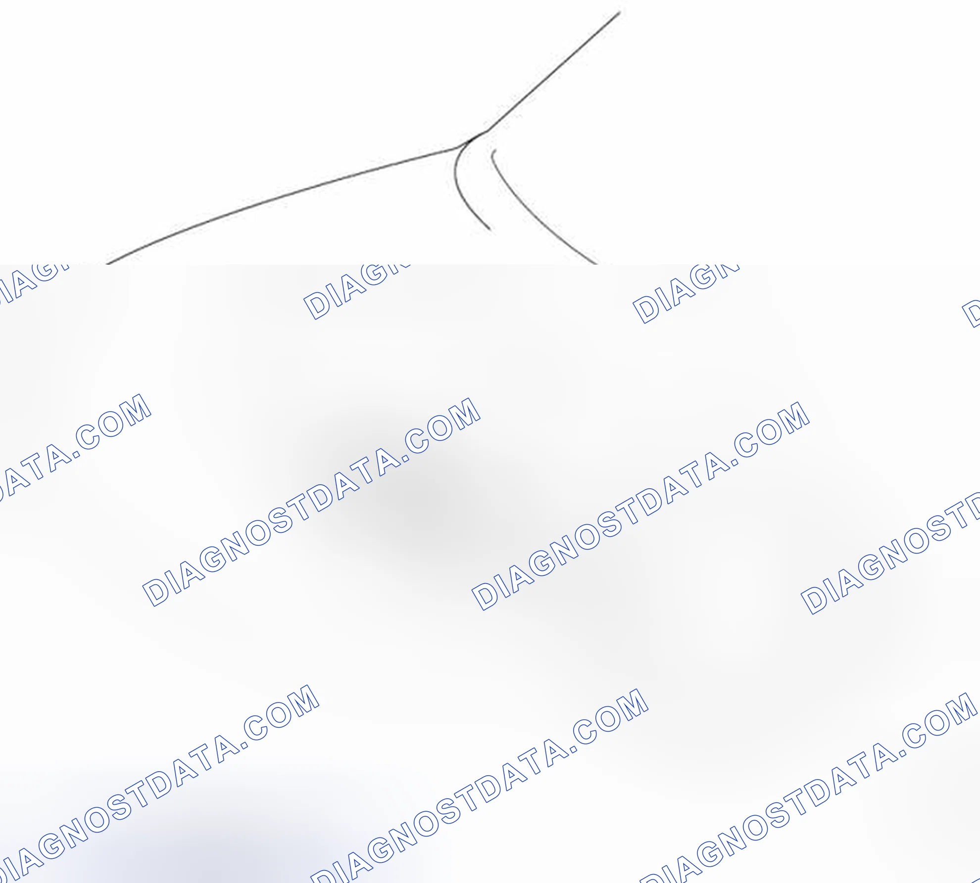 Scheme 30: Engine Mounting
