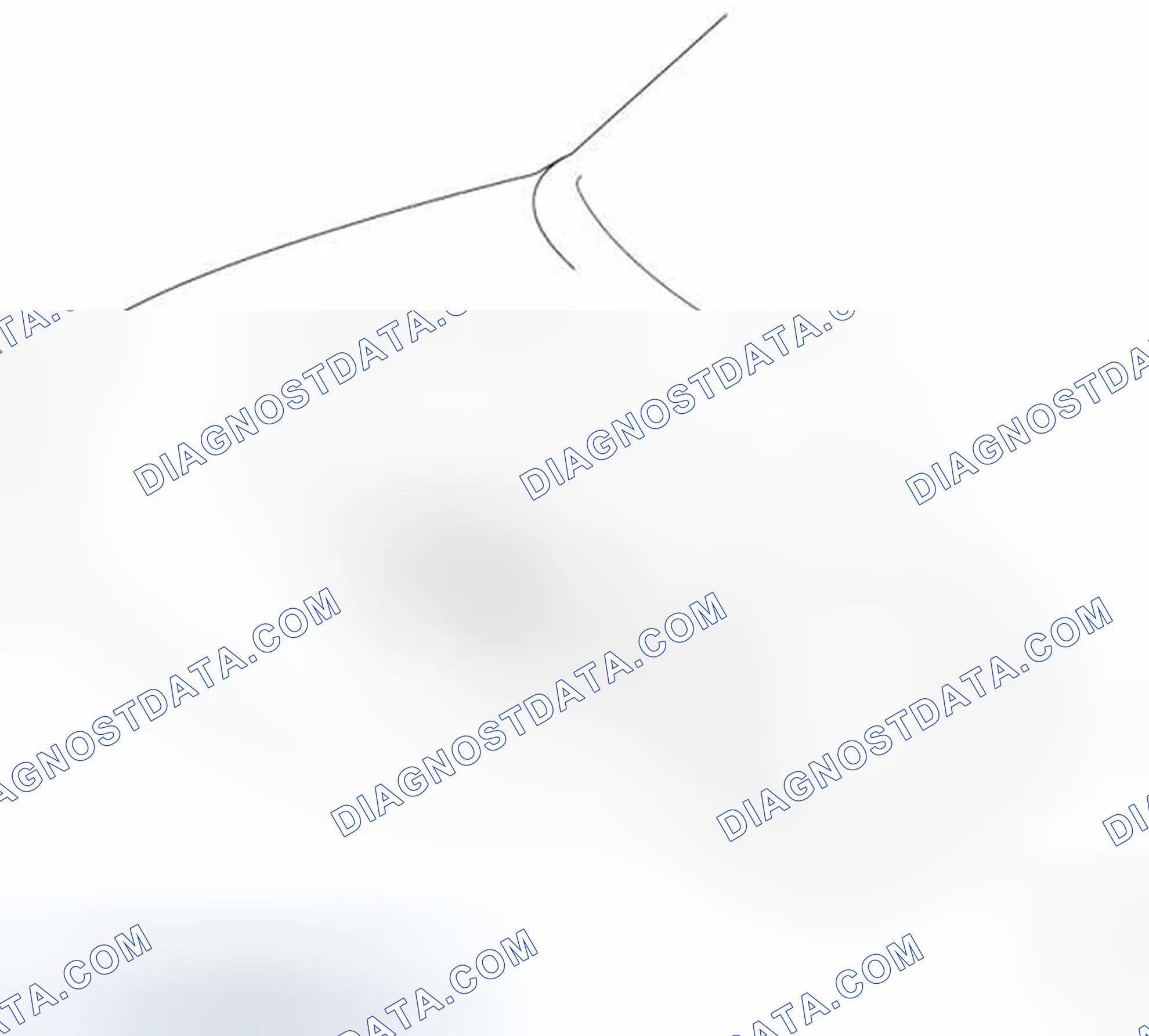 Scheme 30: Engine Mounting