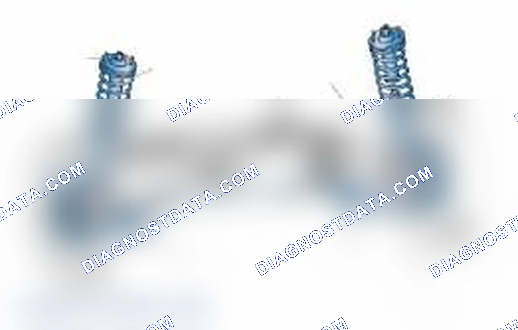Scheme 25: Typical Front Suspension & Steering Components