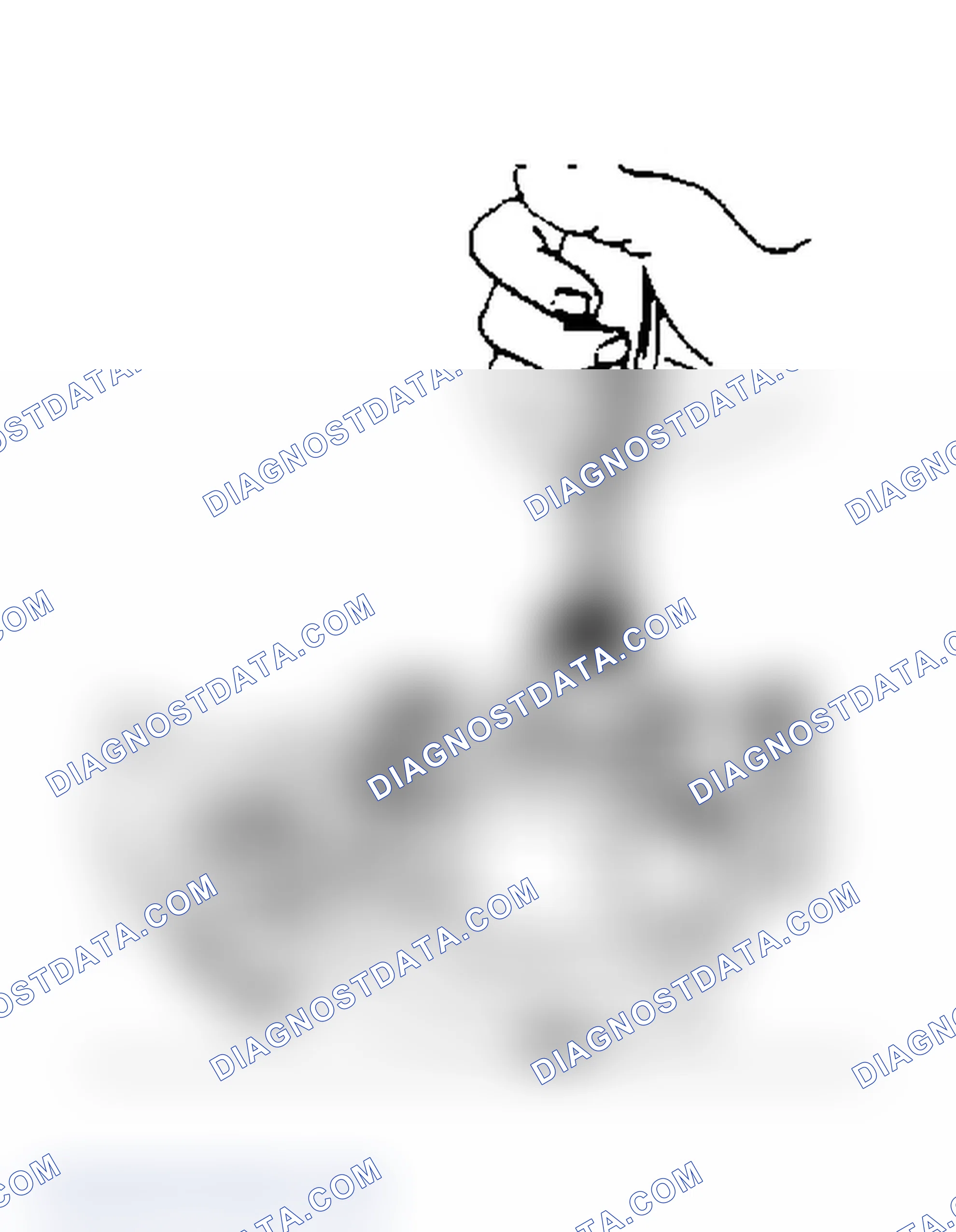 Scheme 13: Remove Seal Snap Ring
