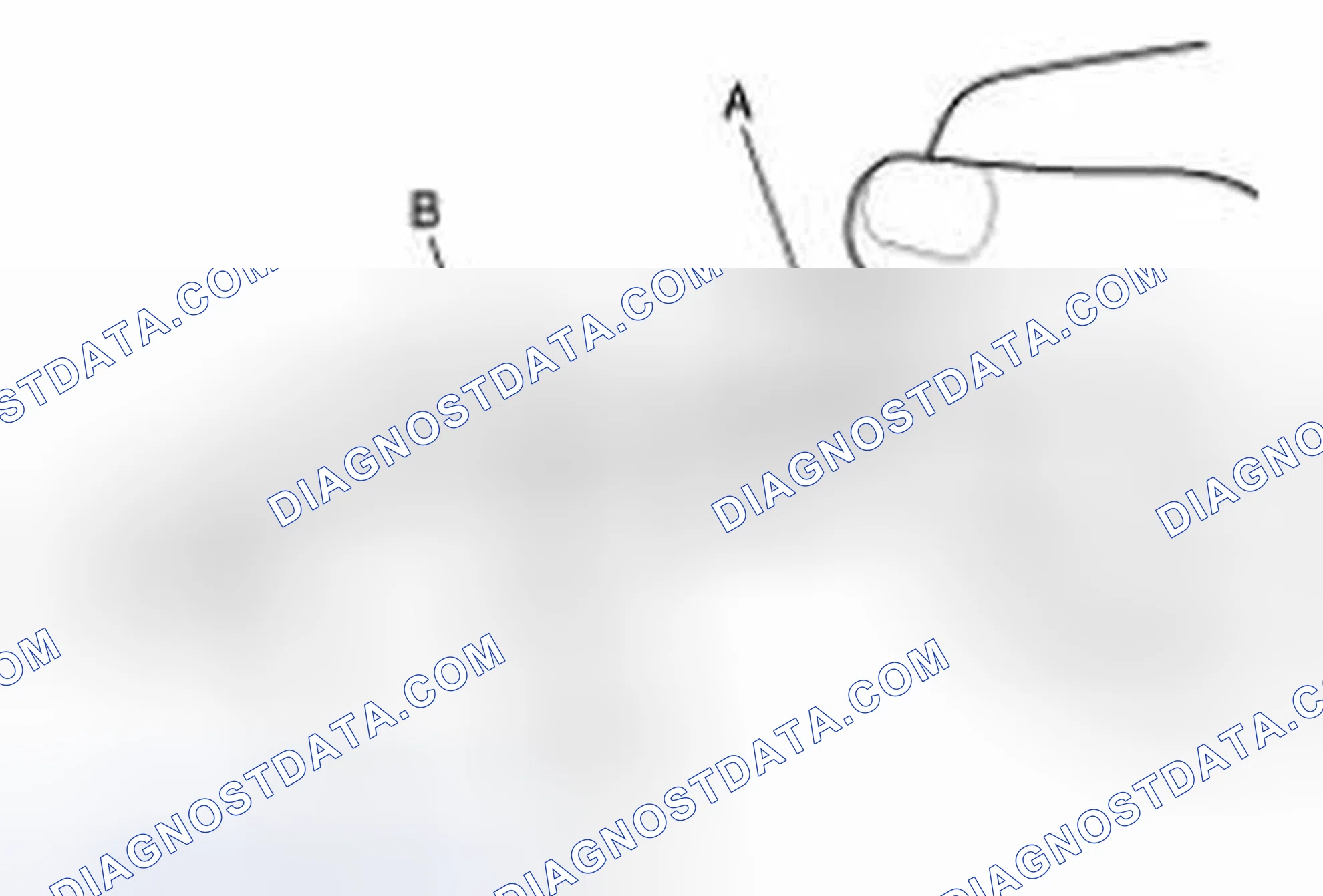 Scheme 11: Inspection