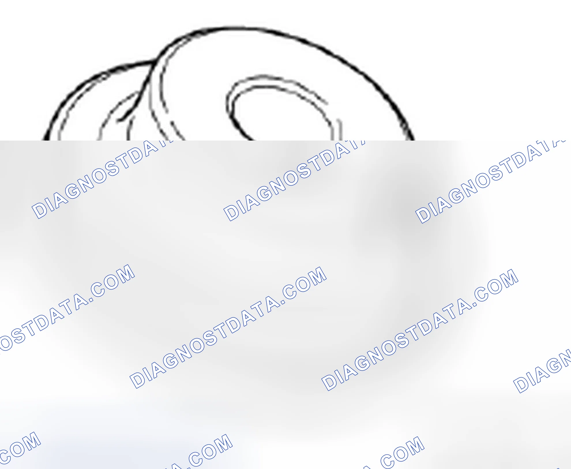 Scheme 280: 11 4 150 Installer bush