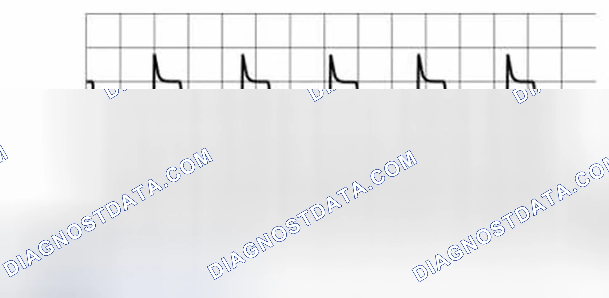 Scheme 81: BCM Pattern 3 (Generated Pulse)