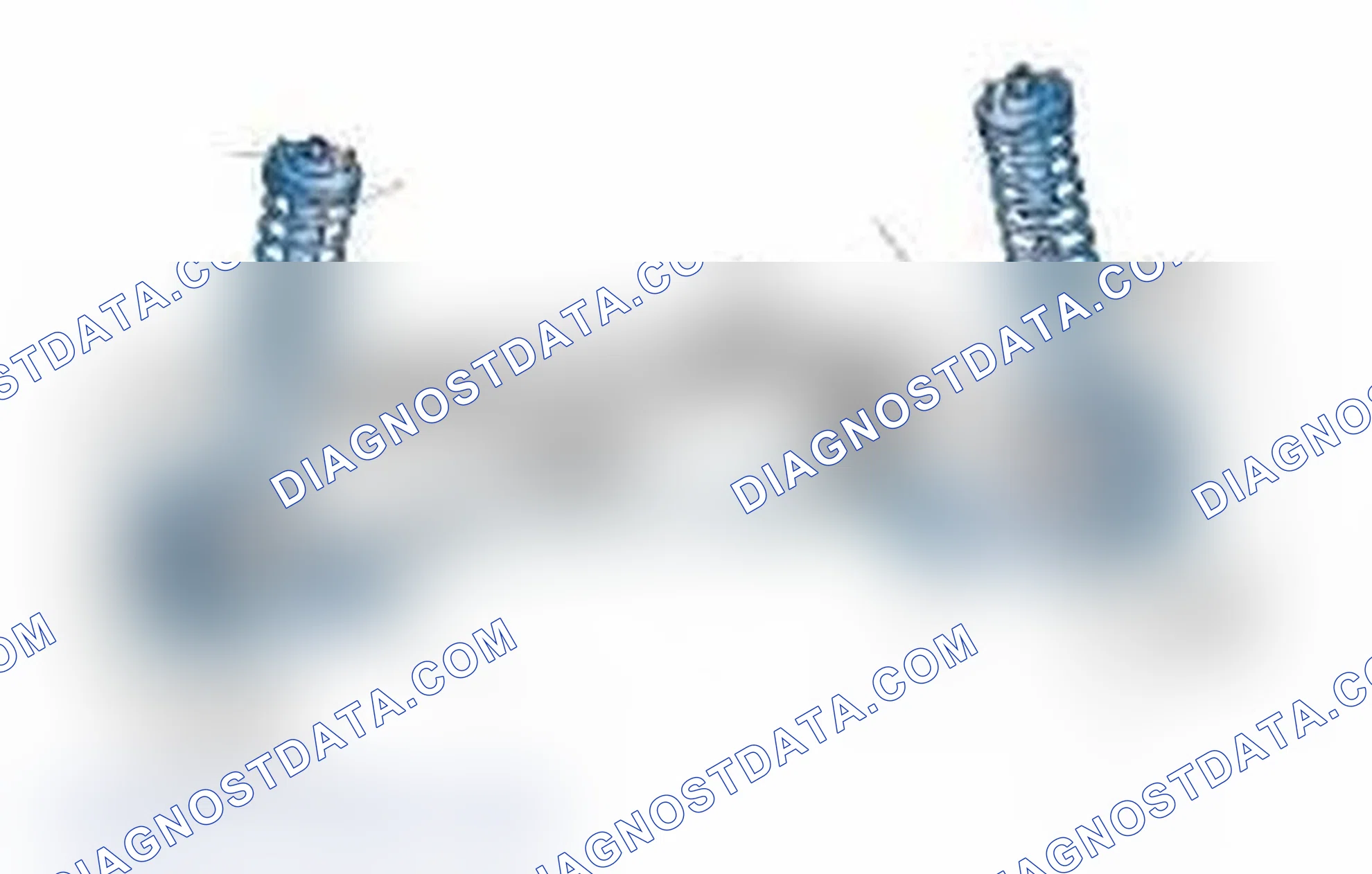 Scheme 25: Typical Front Suspension & Steering Components