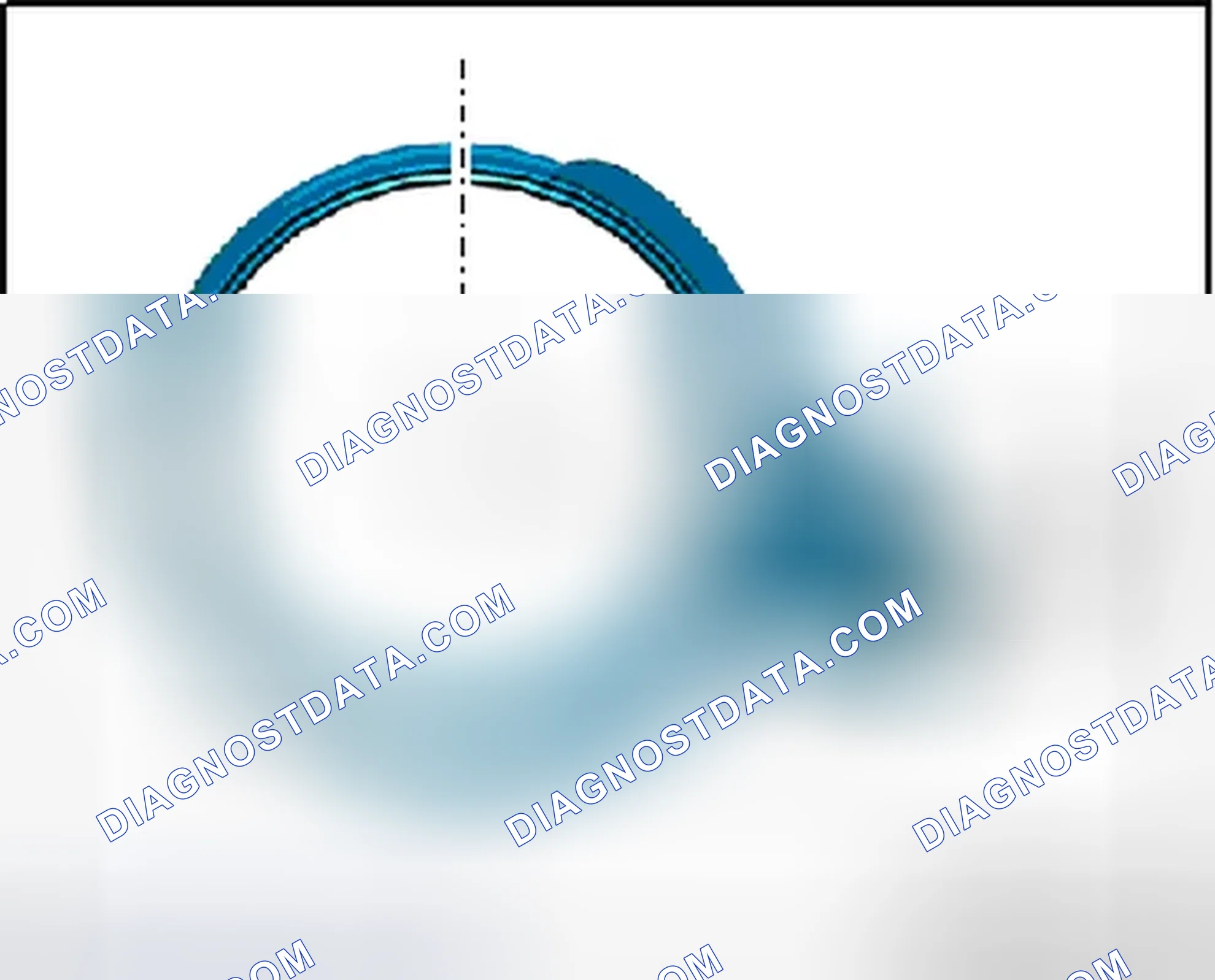 Scheme 60: Installed Position of Front Clamping Sleeve