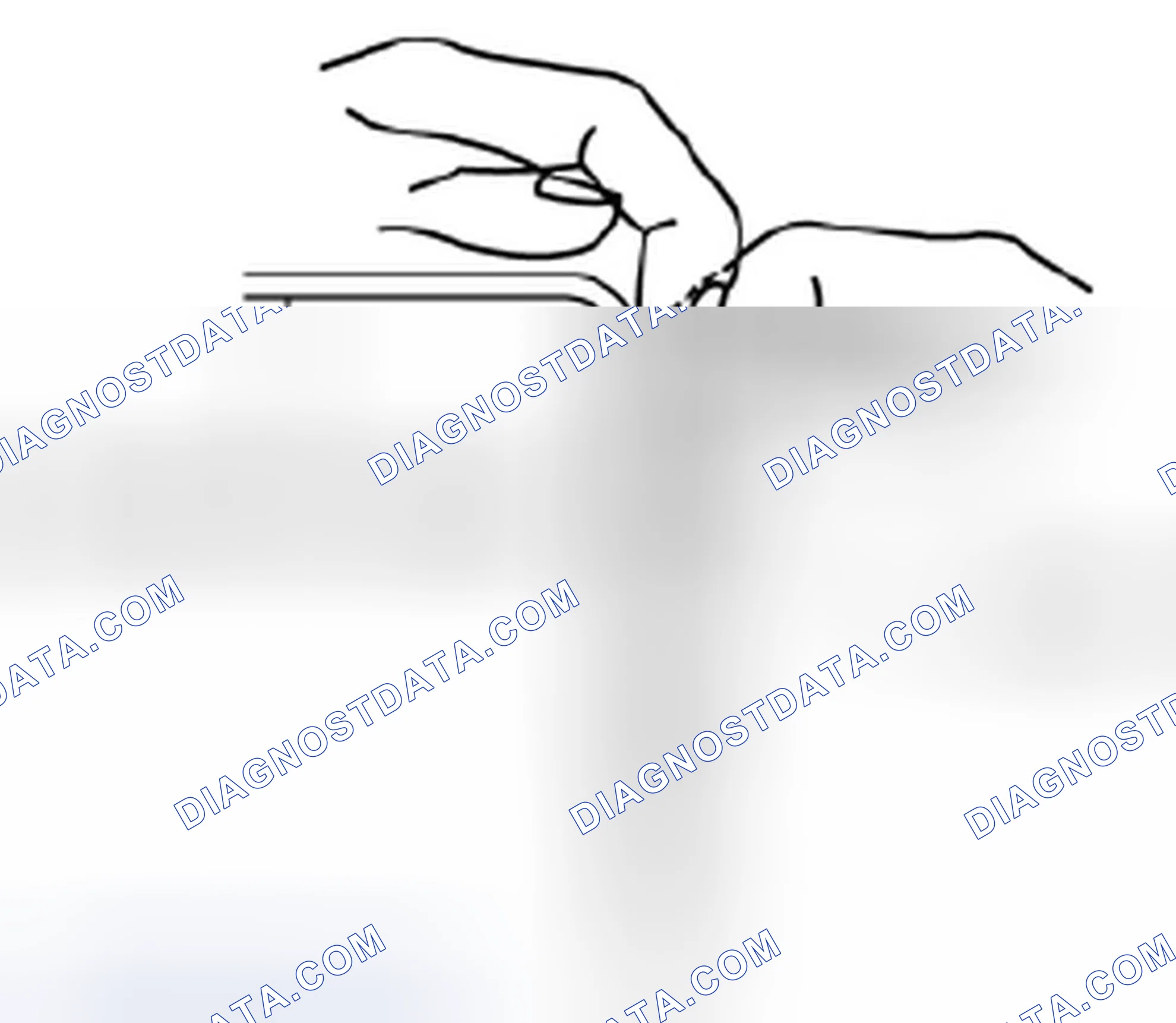 Scheme 59: Pulling Battery Clips