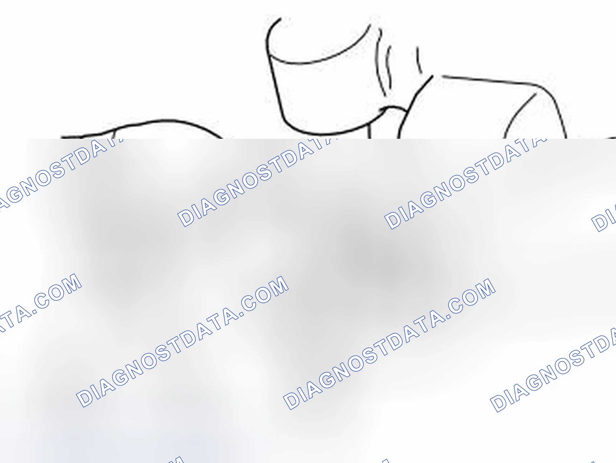 Scheme 100: Cleaning crankcase ventilation