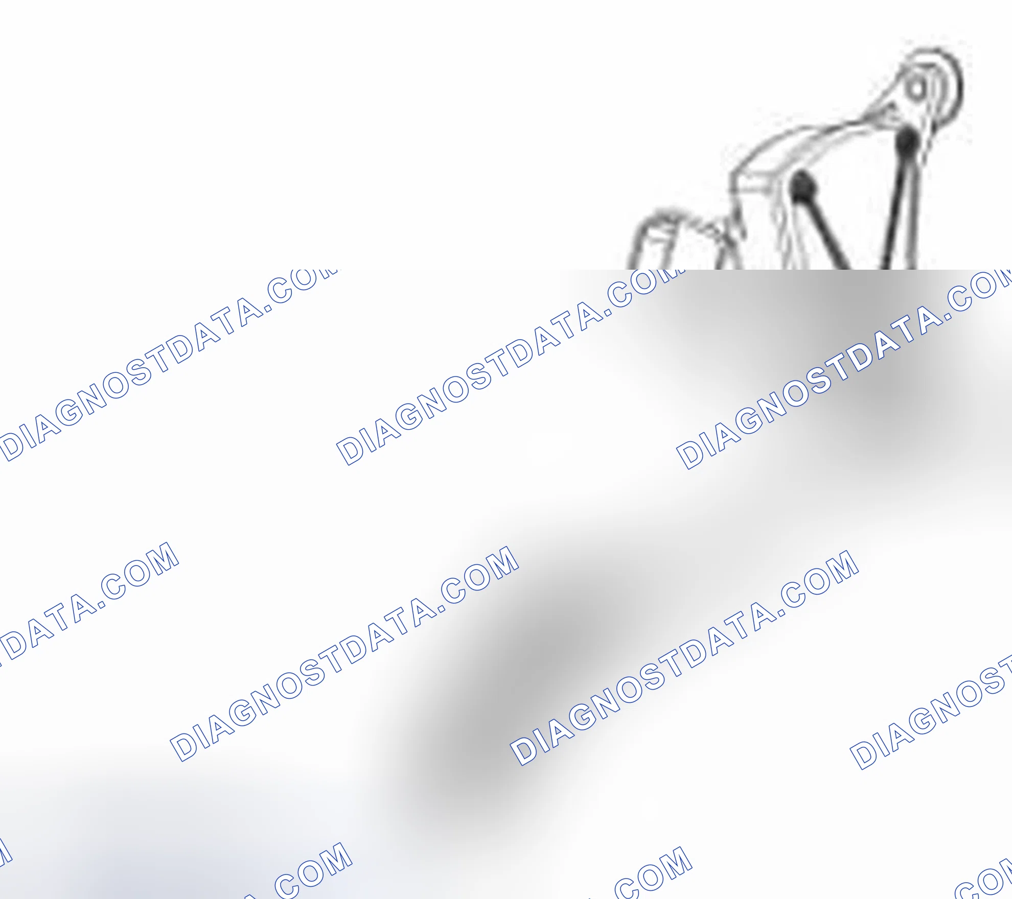 Scheme 18: 3-Track APP Sensor