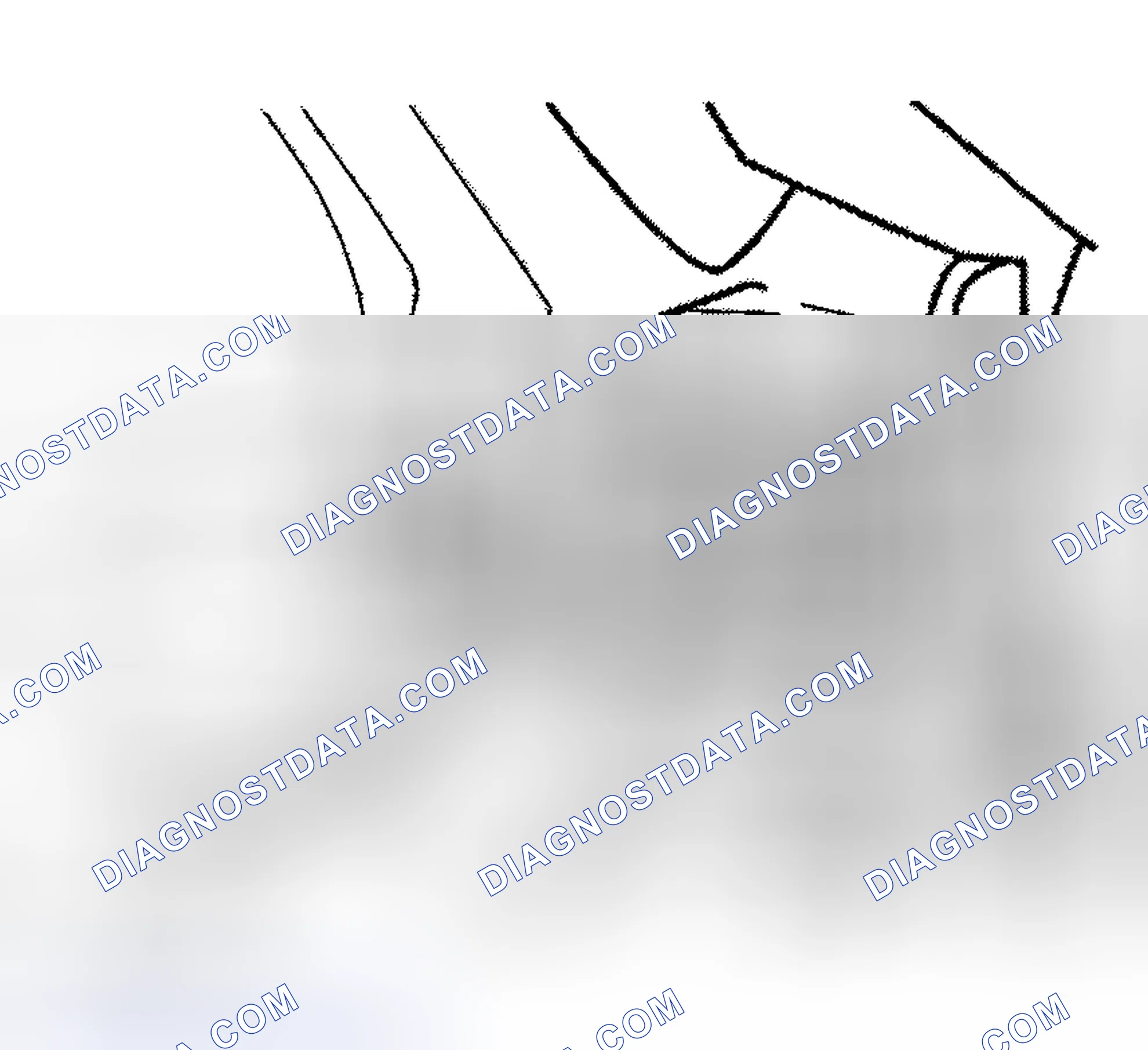 Scheme 9: TOE ADJUSTMENT FRONT