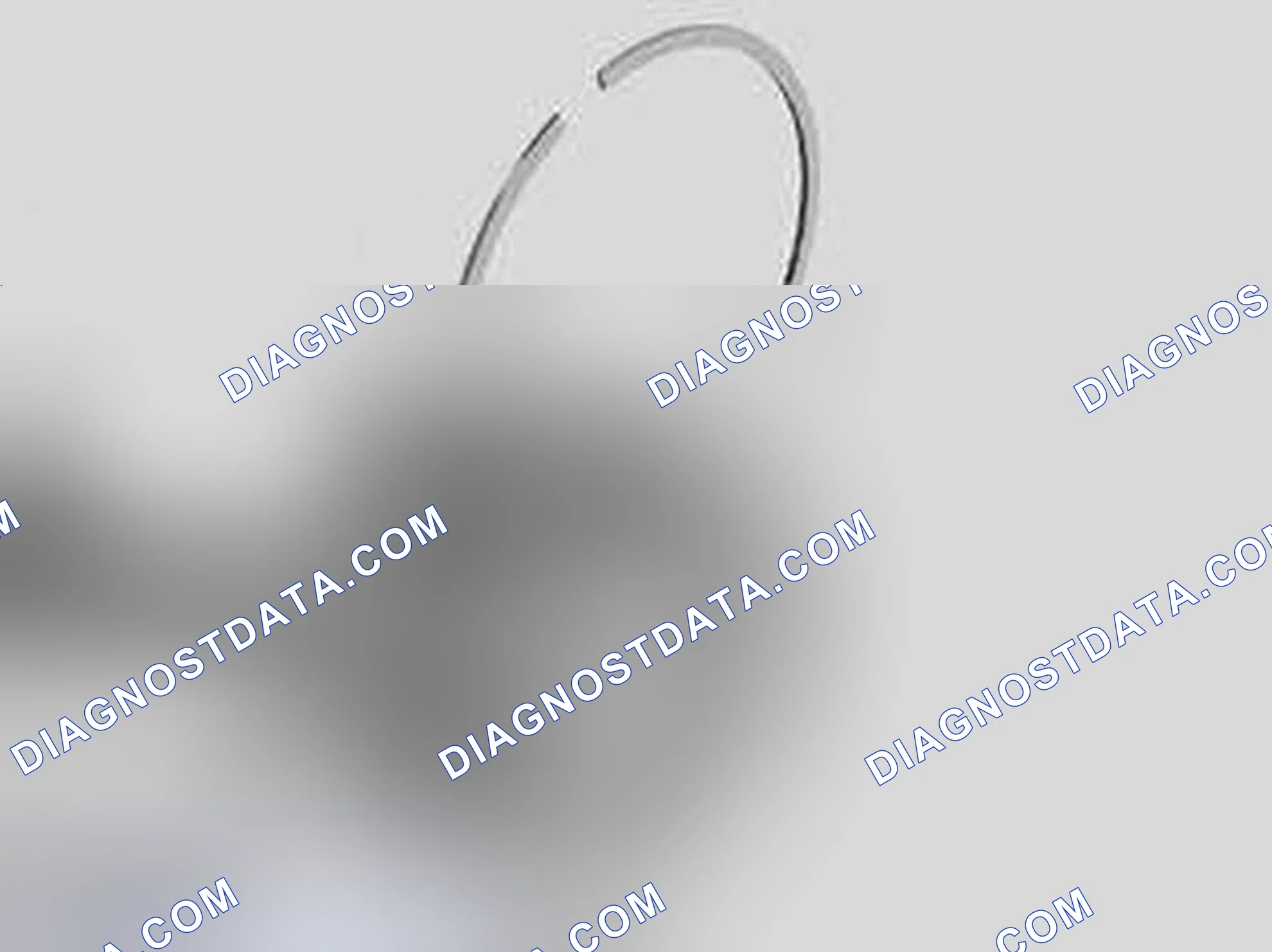 Scheme 238: CHECKING PISTON RING AXIAL CLEARANCE