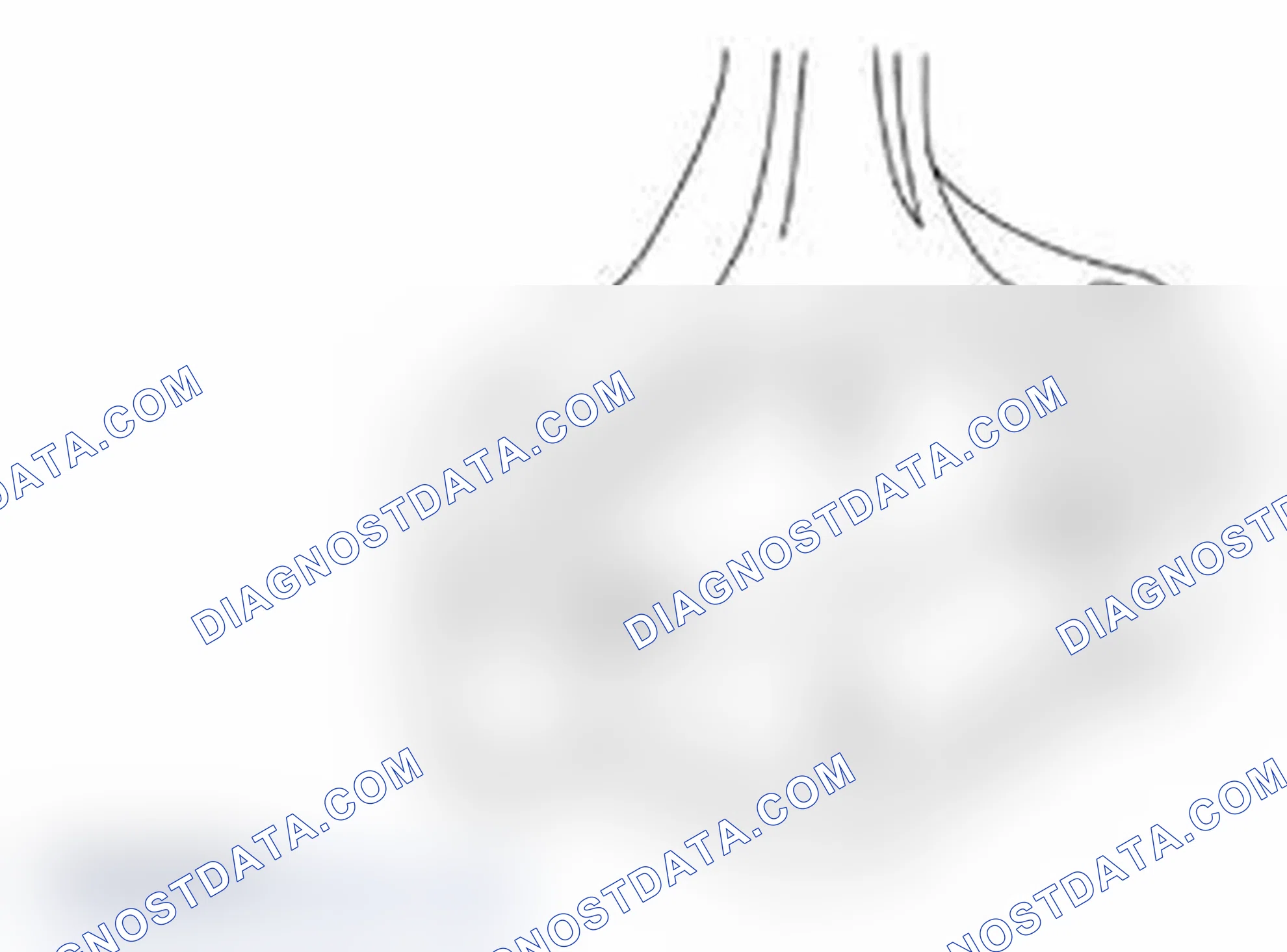 Scheme 1536: Connecting Rod Large End Bore