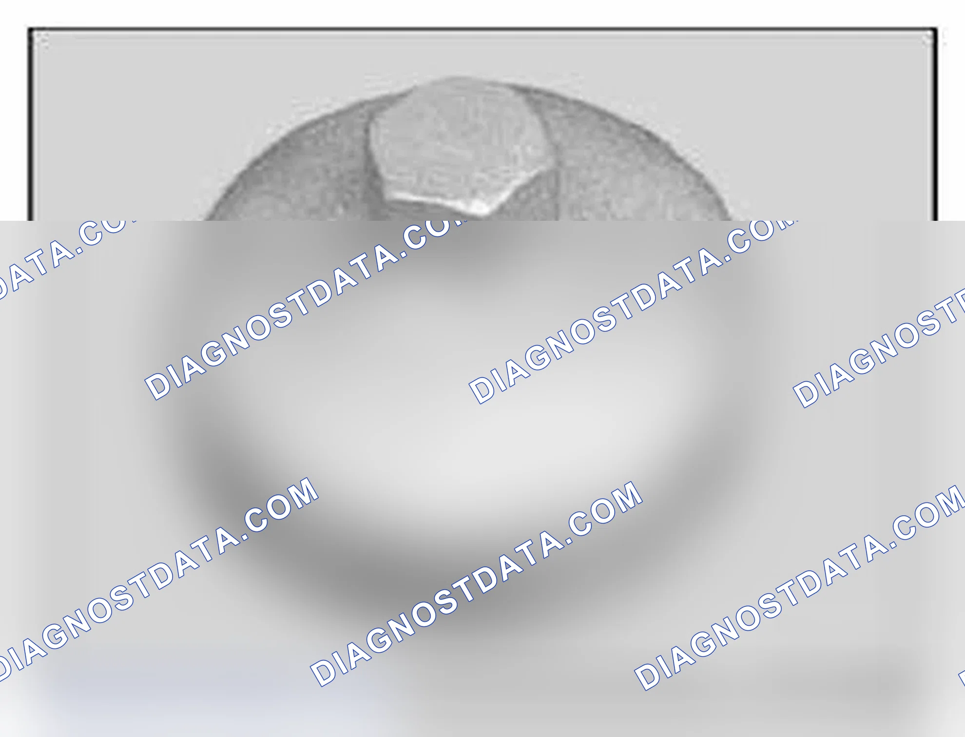 Scheme 119: 11-9240 Oil filter wrench
