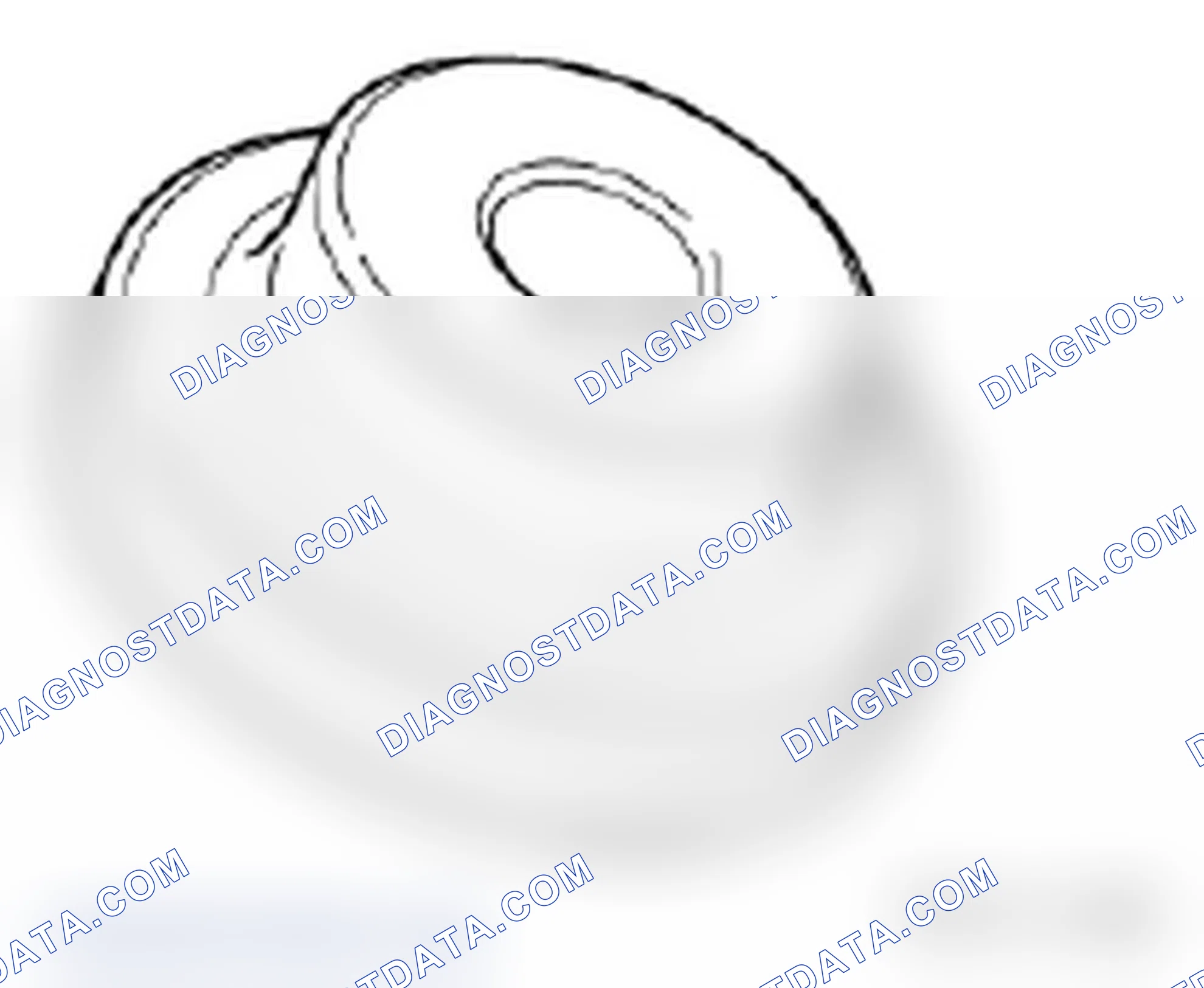 Scheme 309: 11 4 150 Installer bush