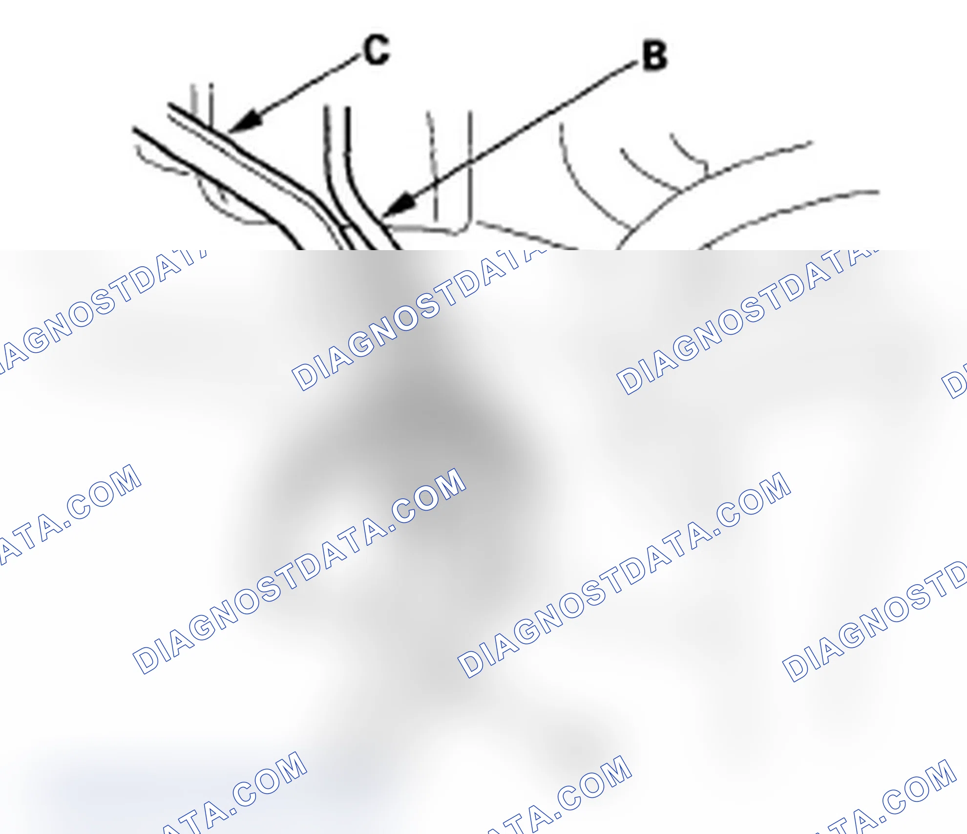Scheme 54: Brake Hose Replacement
