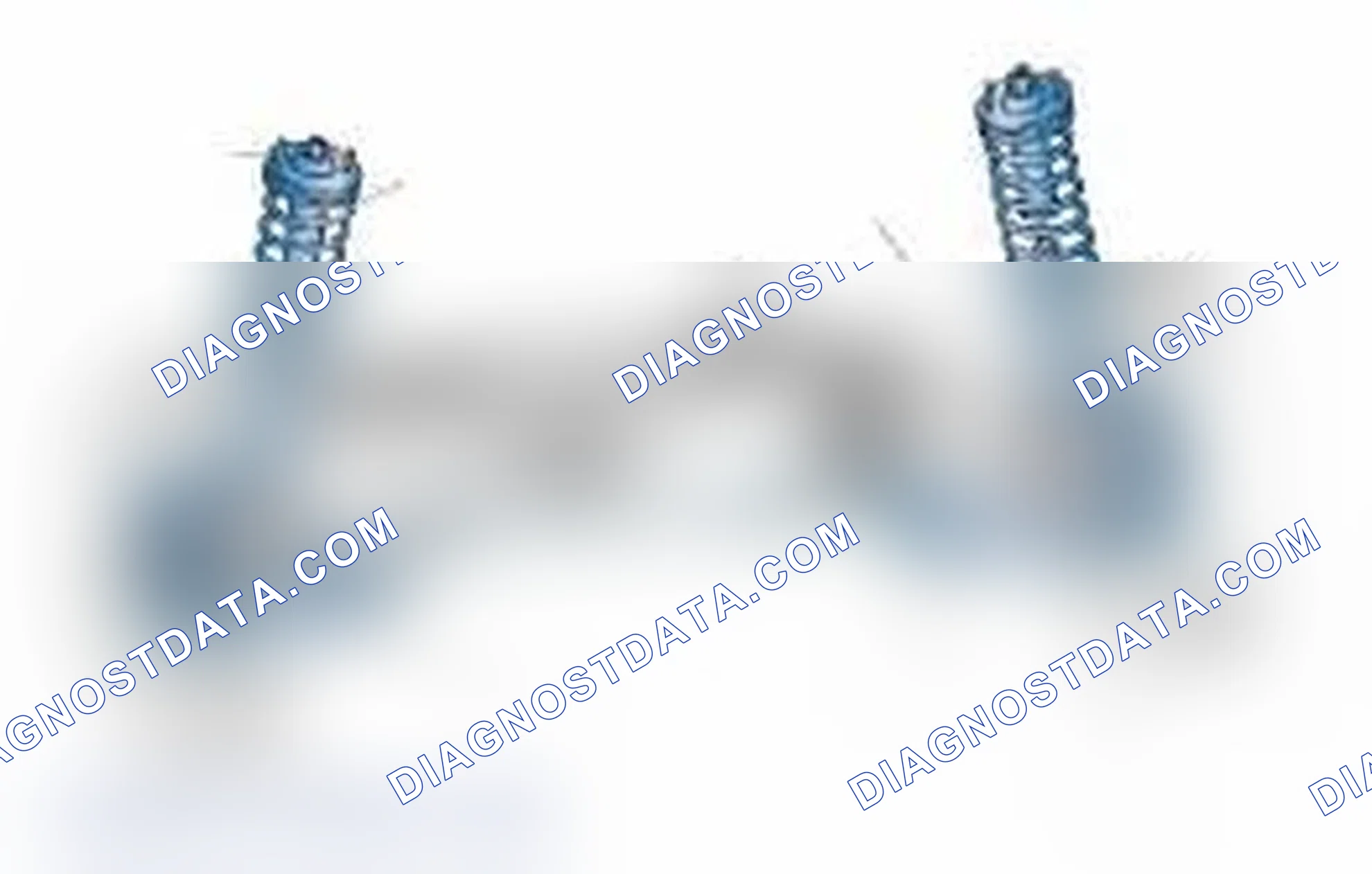 Scheme 25: Typical Front Suspension & Steering Components