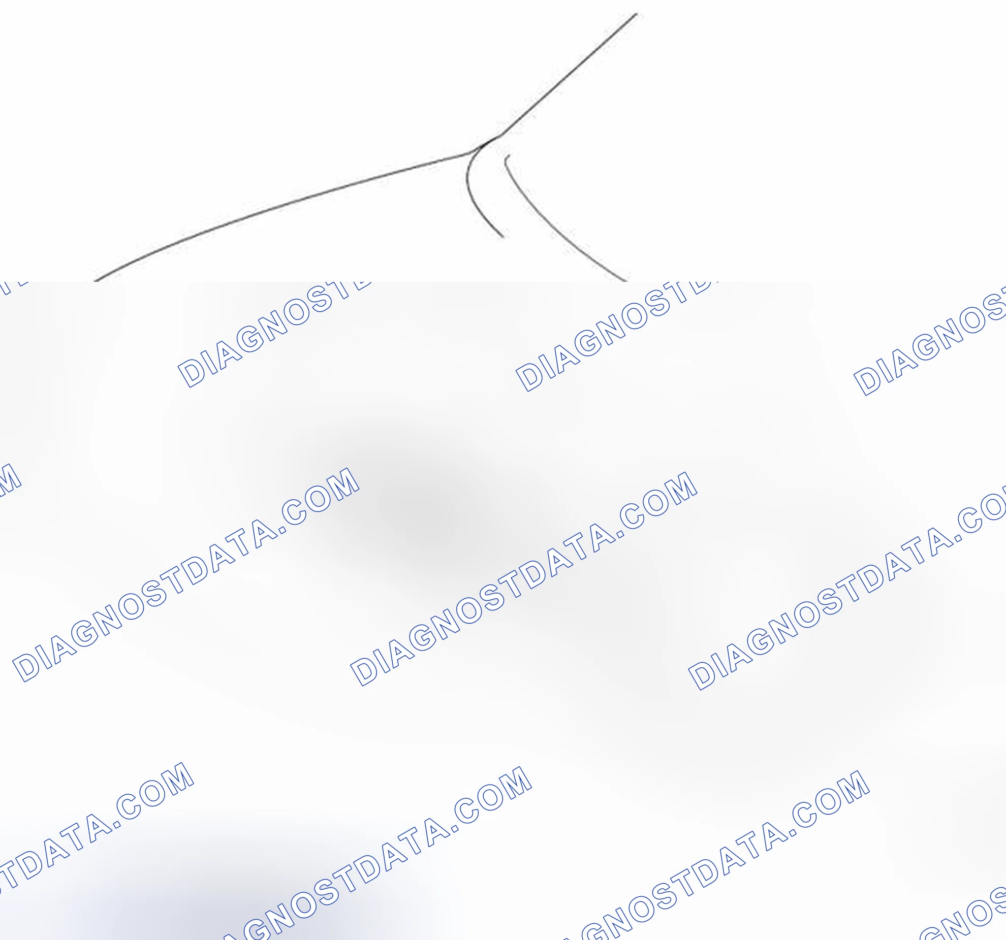 Scheme 69: Engine Mounting