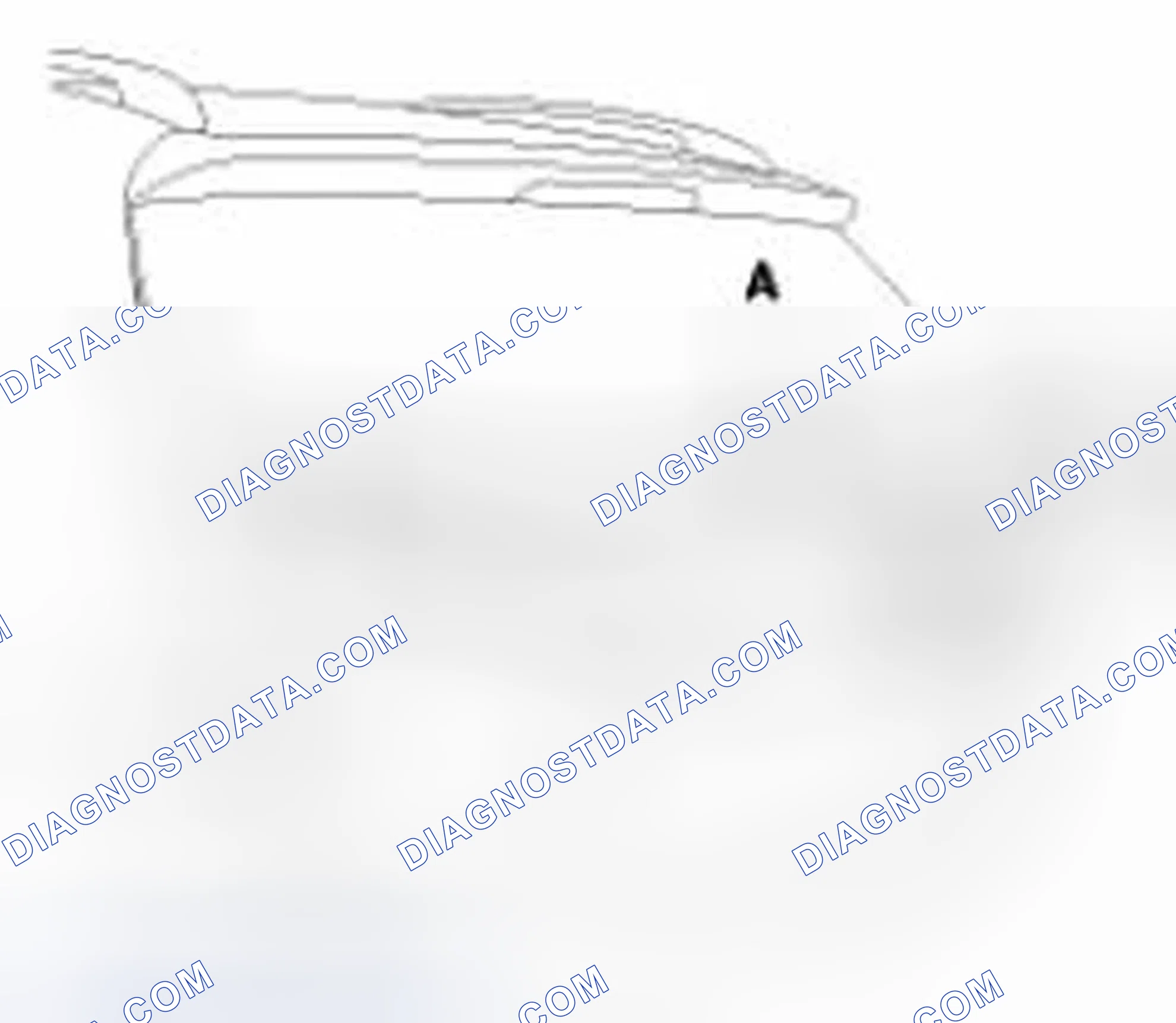Scheme 3: Removal