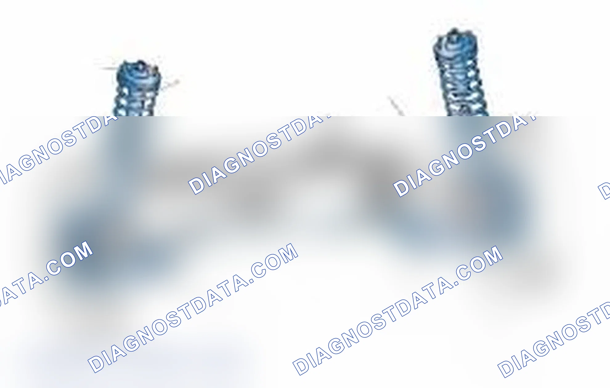 Scheme 25: Typical Front Suspension & Steering Components