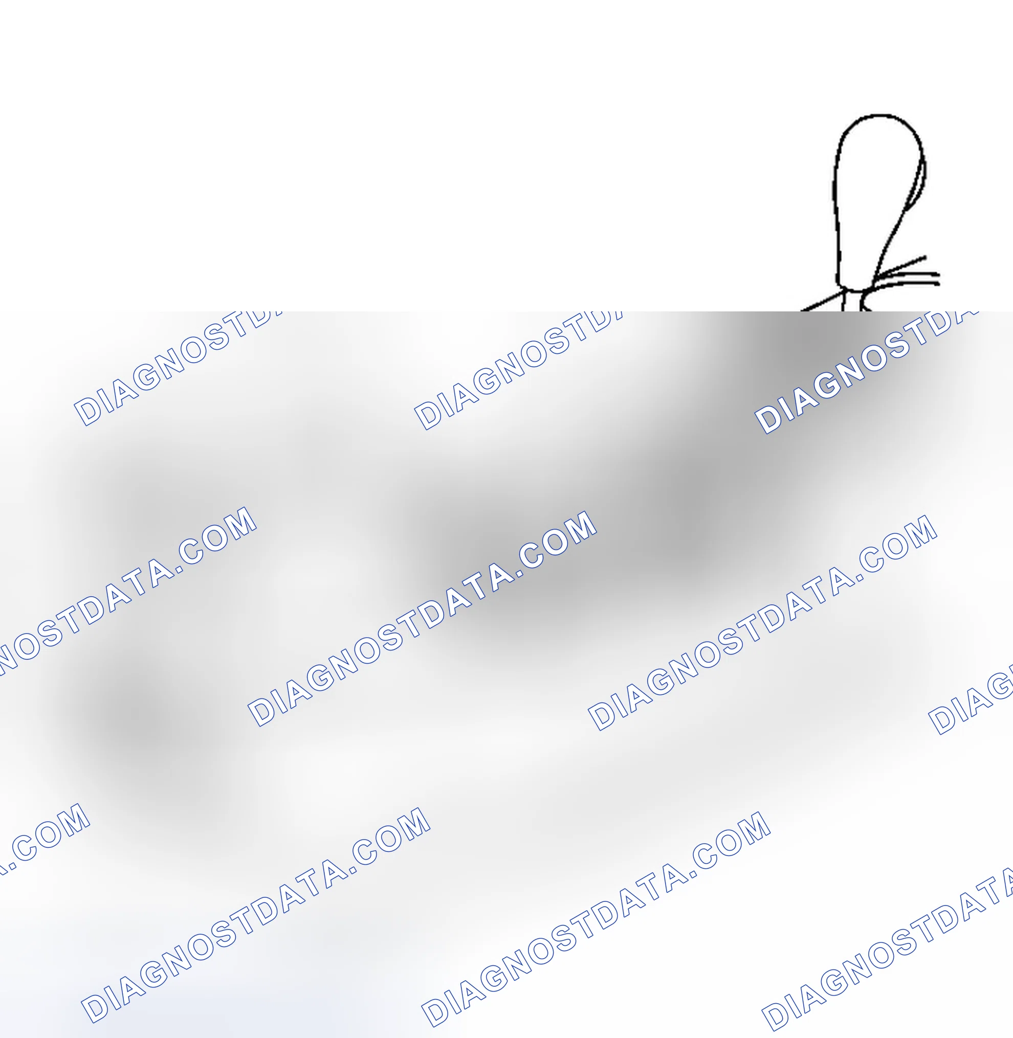 Scheme 3: Removal Procedure