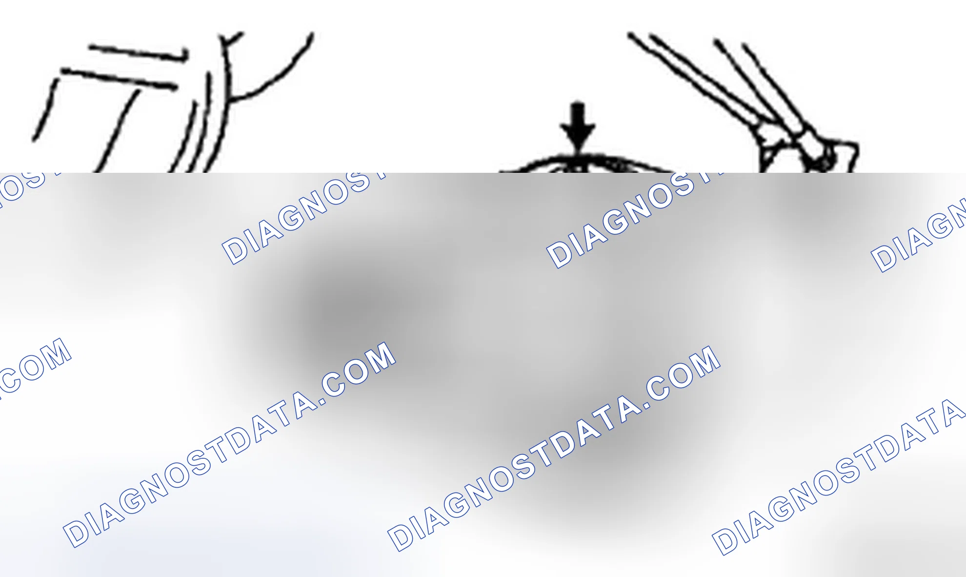 Scheme 108: DISASSEMBLY