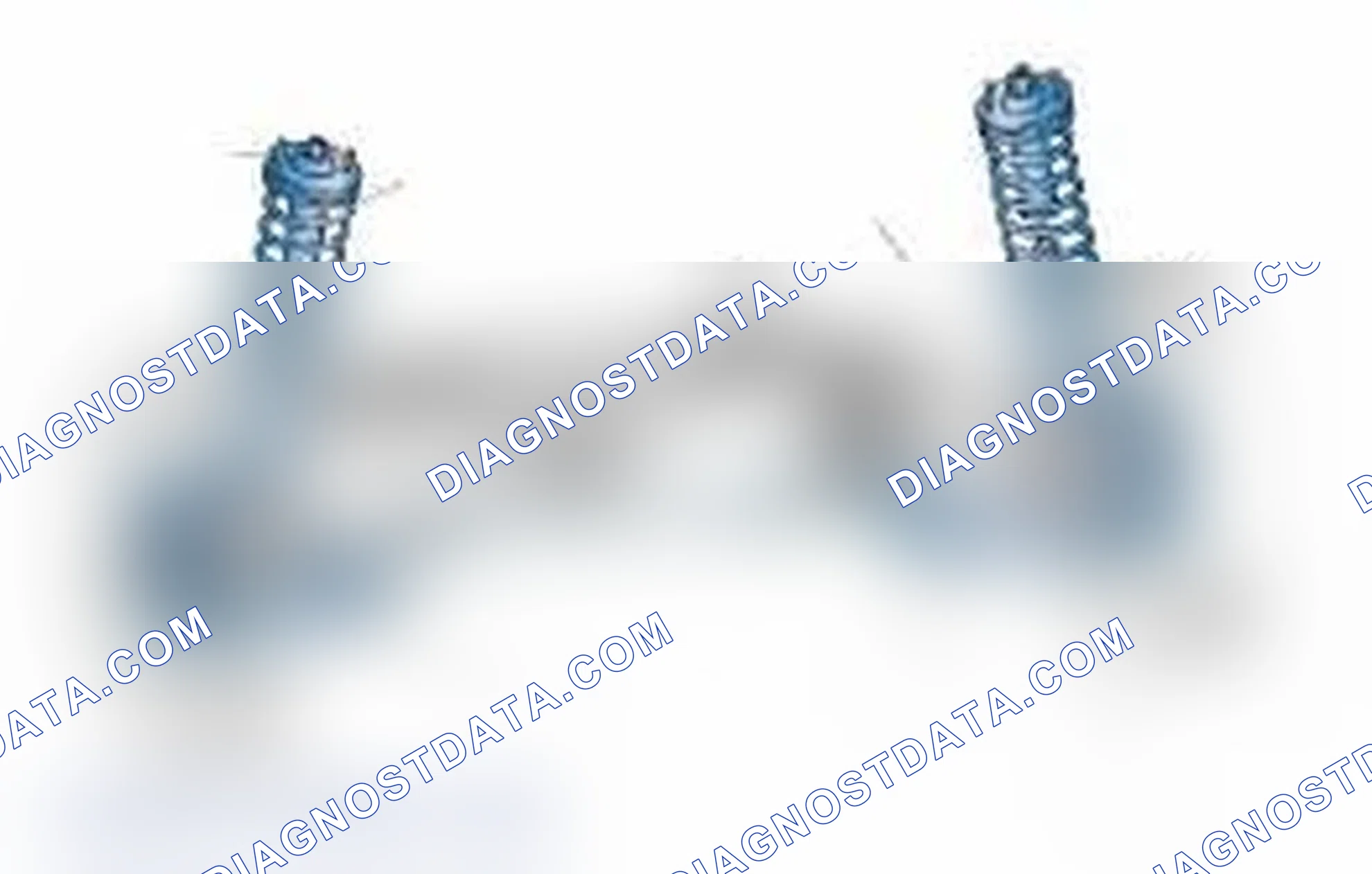 Scheme 25: Typical Front Suspension & Steering Components