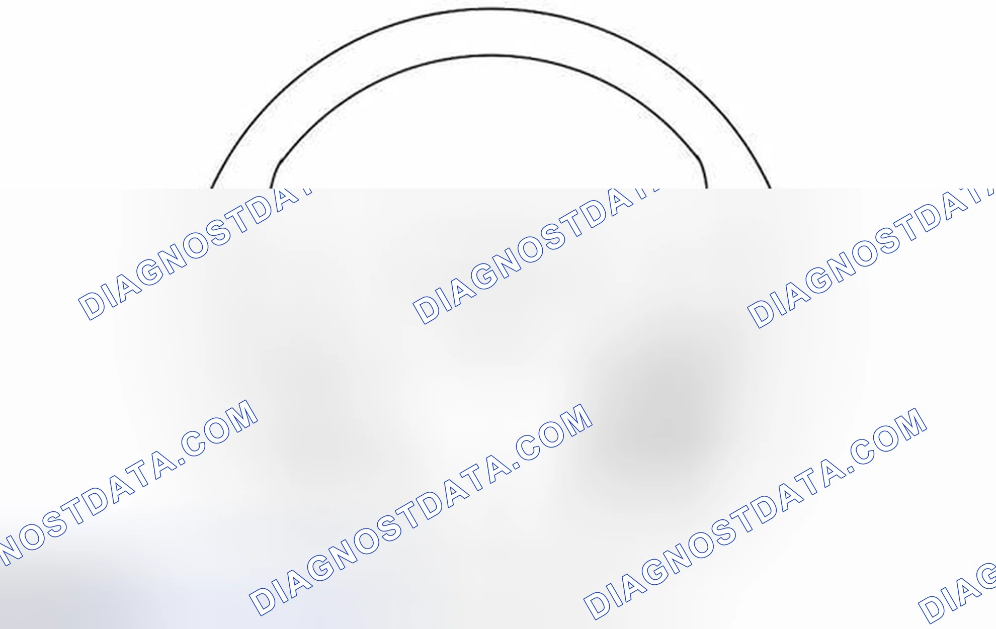 Scheme 2: Speed Control Steering Wheel Switches