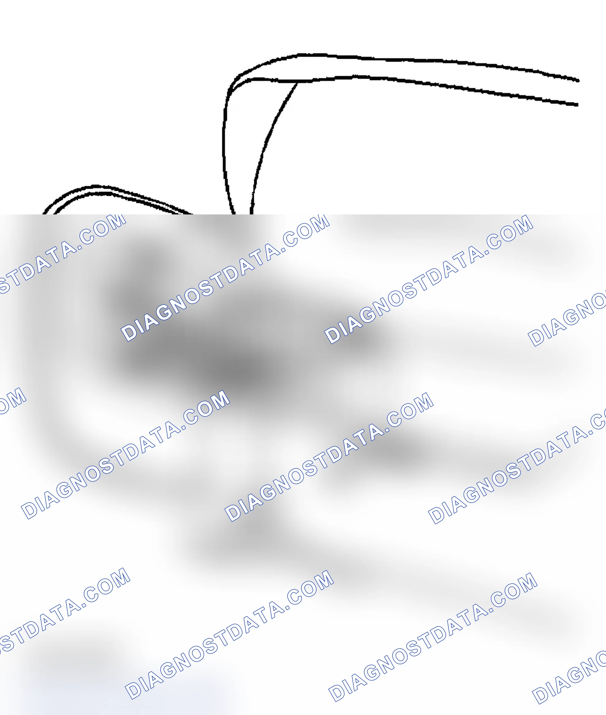 Scheme 36: Installation Procedure