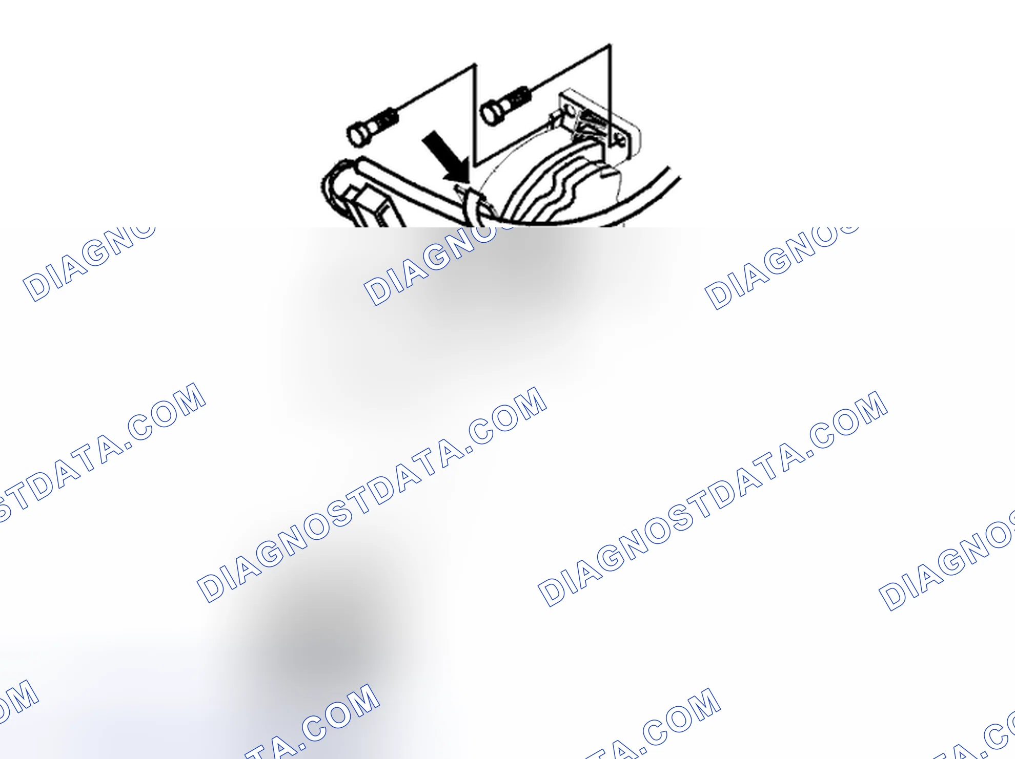Scheme 263: Removing the accelerator pedal module