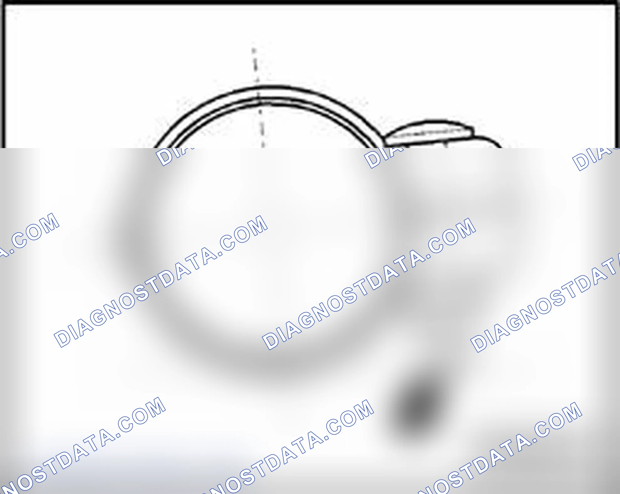 Scheme 232: Installed position of front clamp