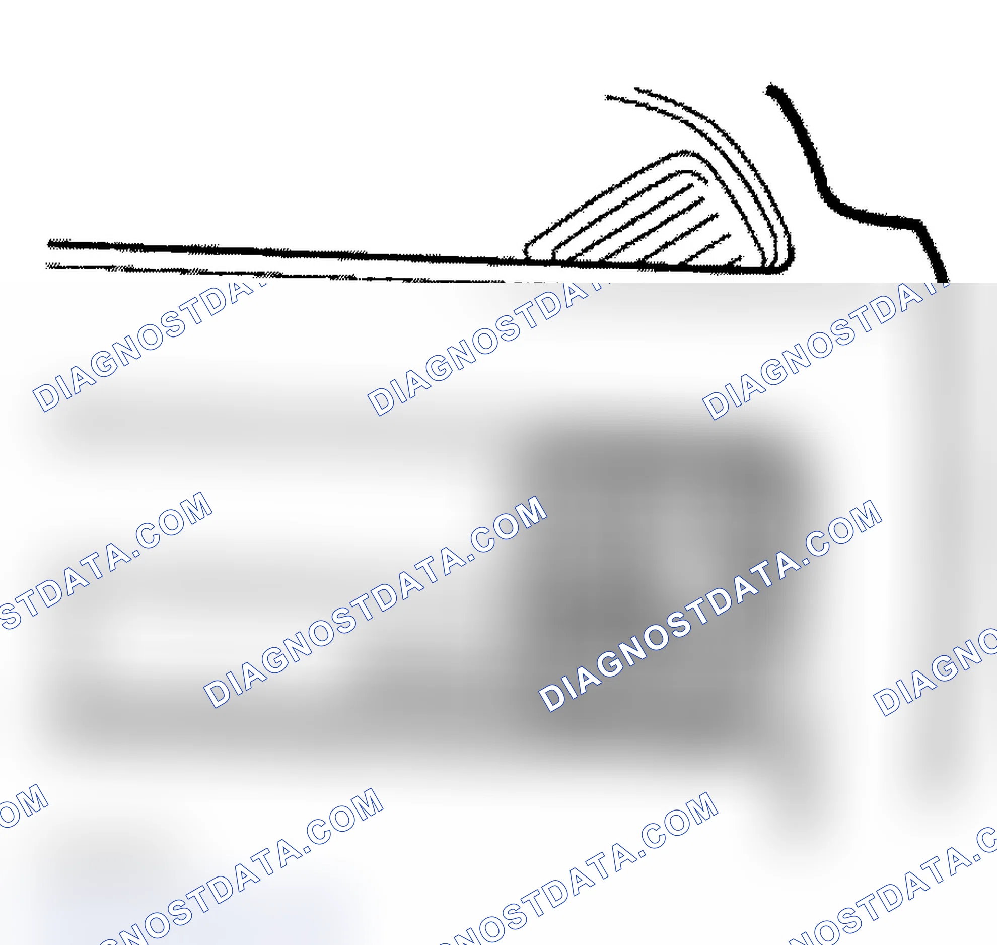 Scheme 8: Removal