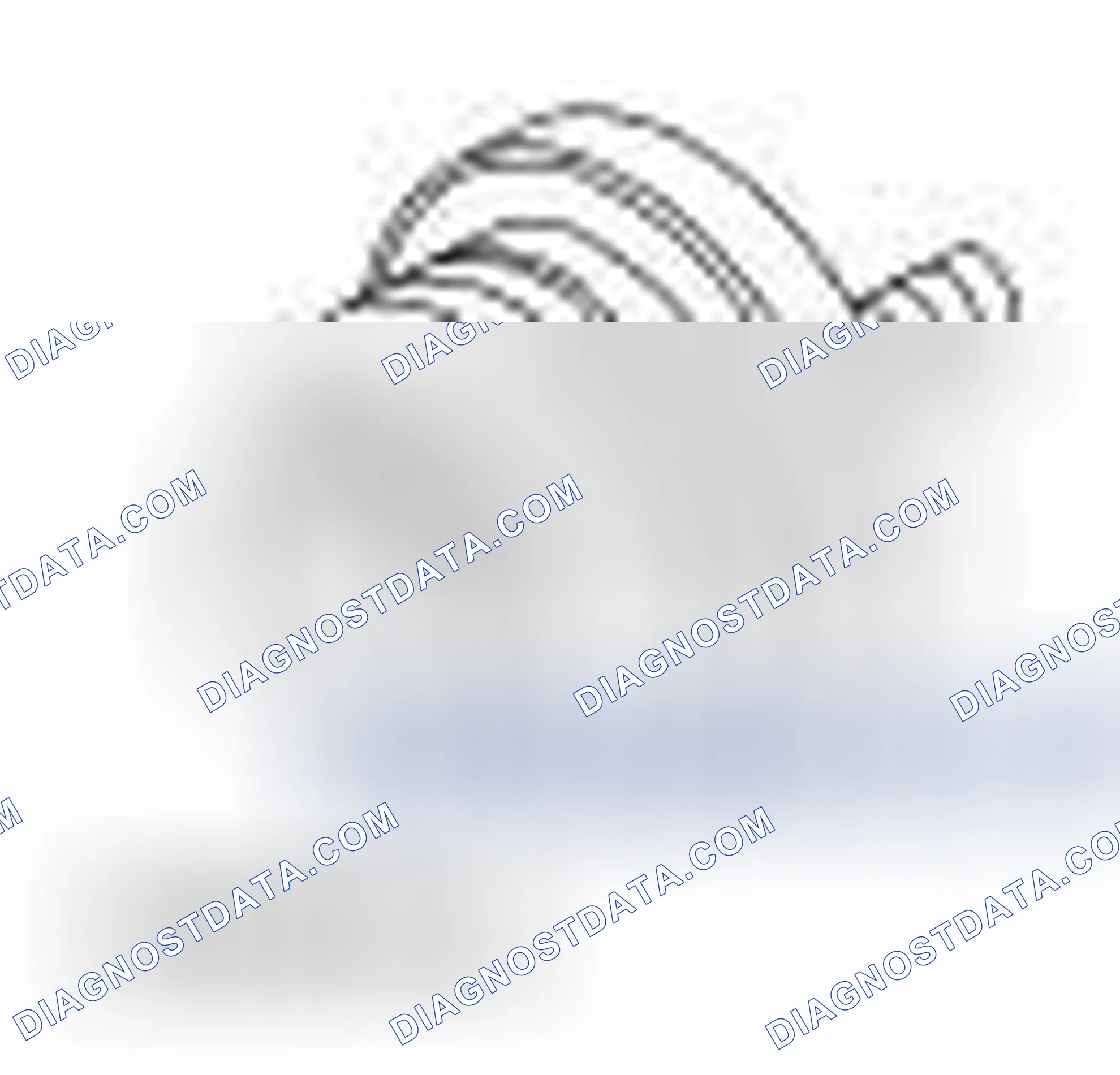 Scheme 290: Special Tool(s)