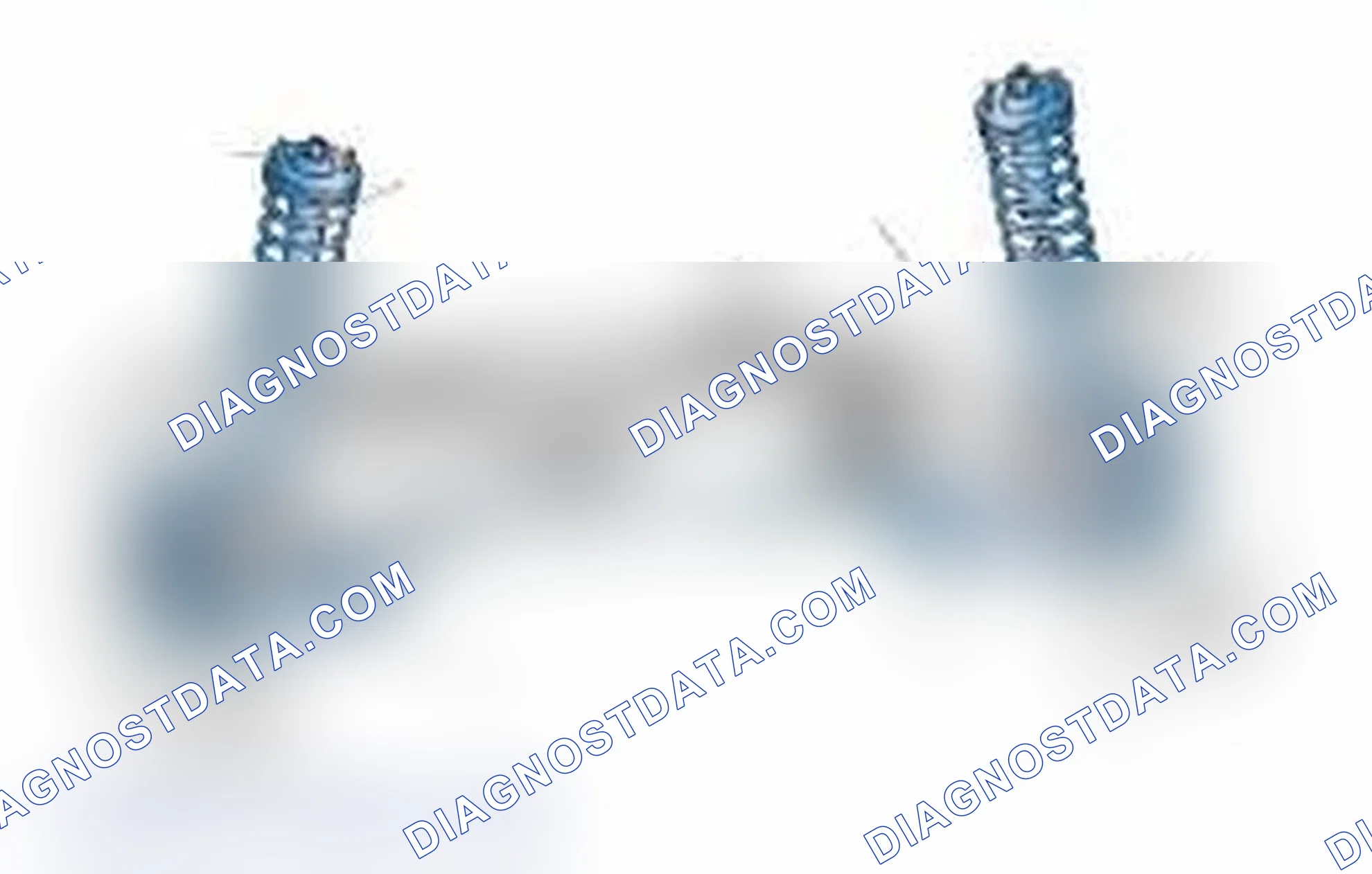 Scheme 25: Typical Front Suspension & Steering Components
