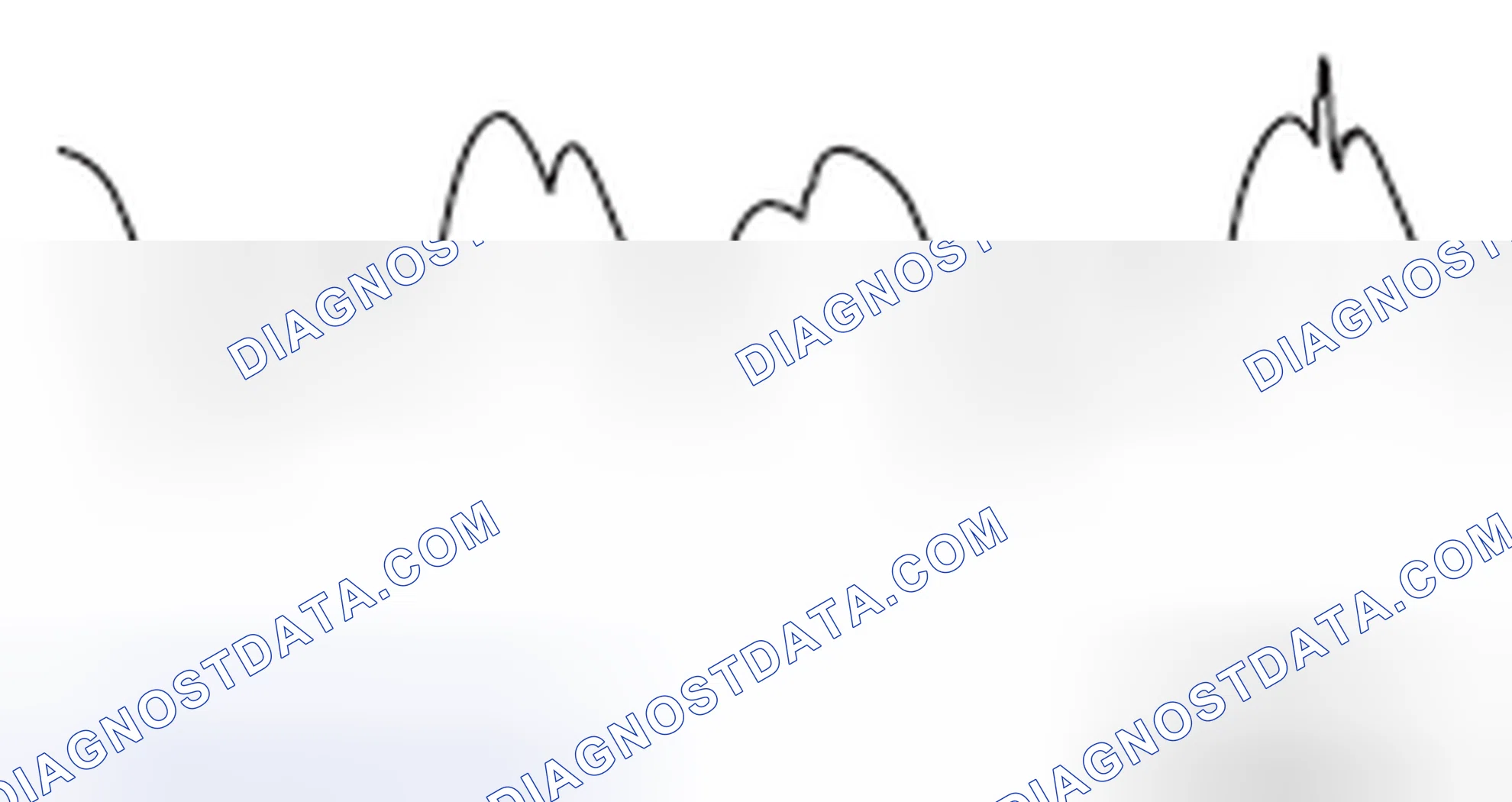 Scheme 32: ABNORMAL WAVEFORMS