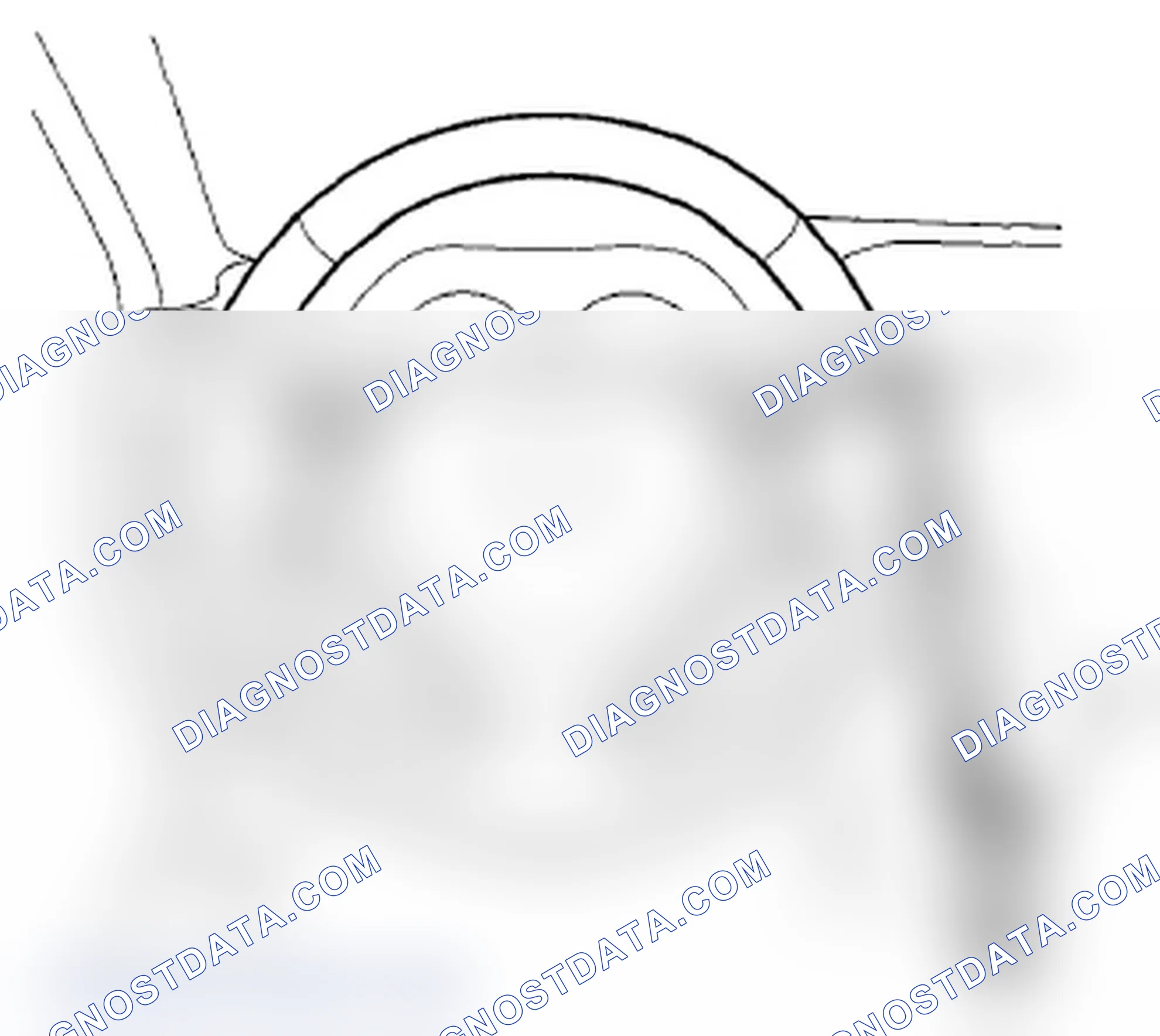 Scheme 37: Power Assist Check