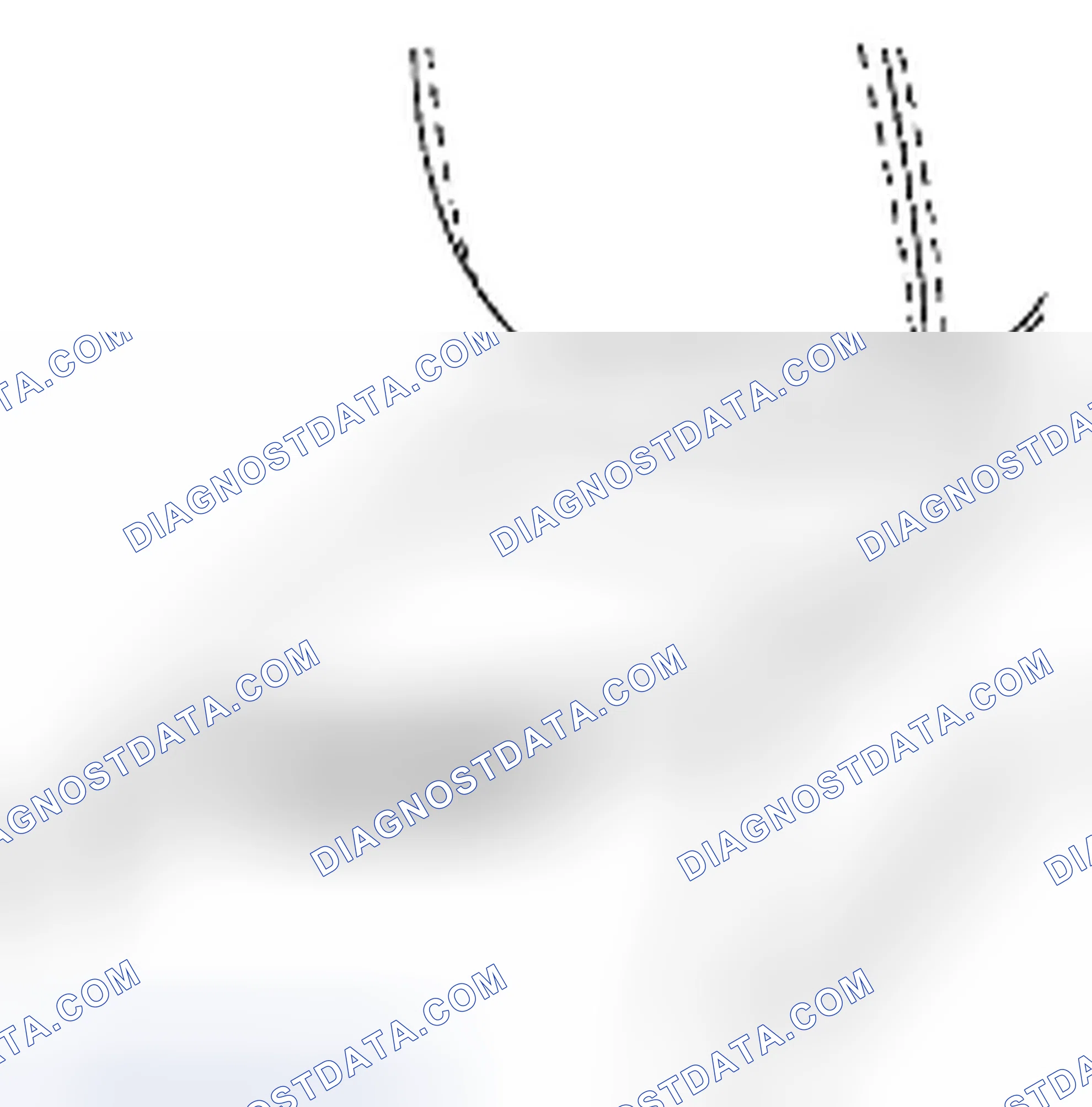 Scheme 3: Front Side Air Bag Description