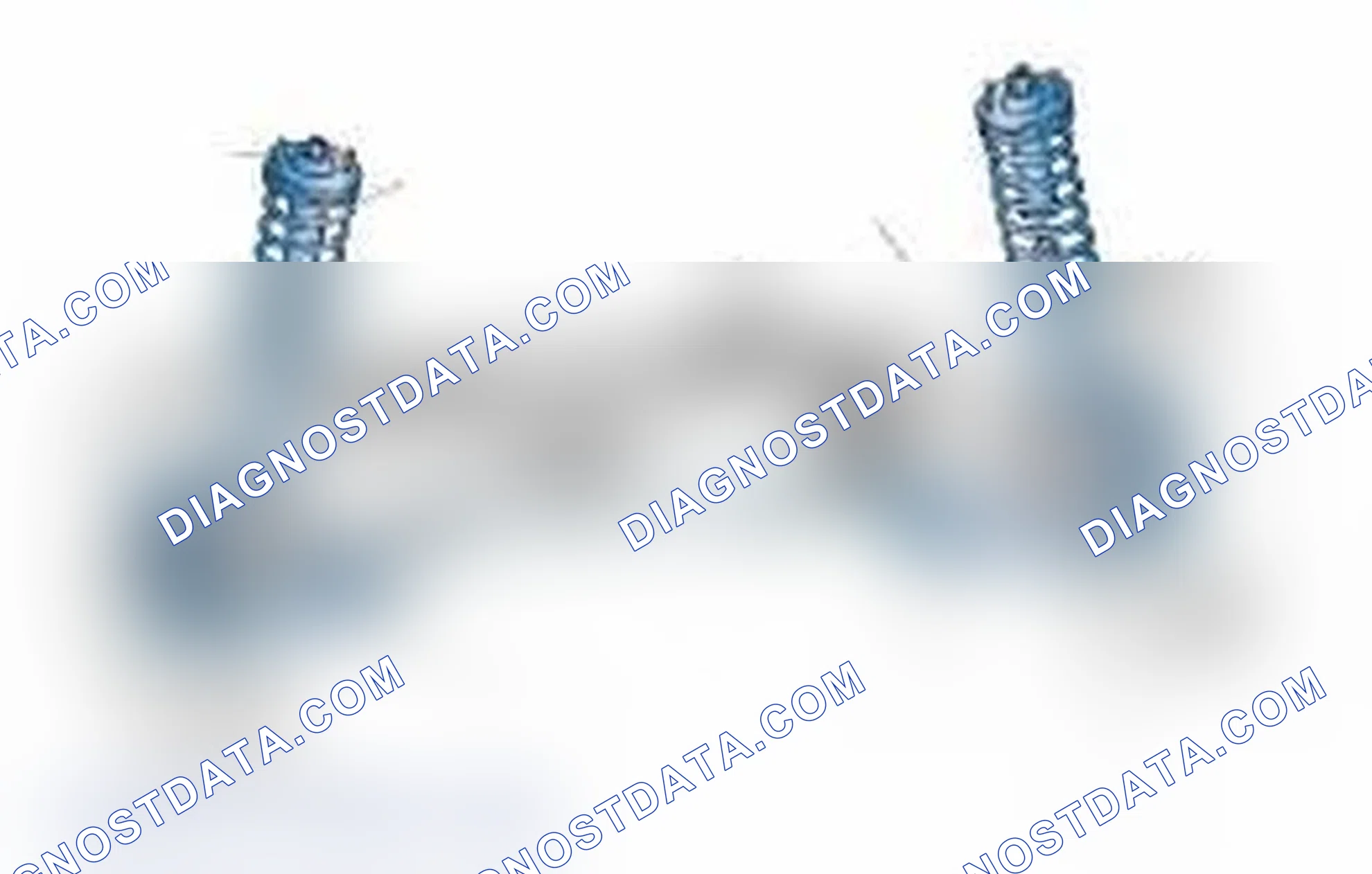 Scheme 25: Typical Front Suspension & Steering Components