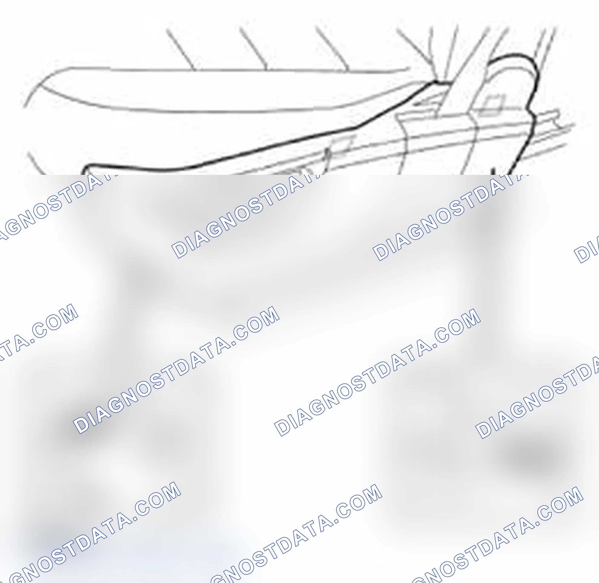 Scheme 47: REMOVAL