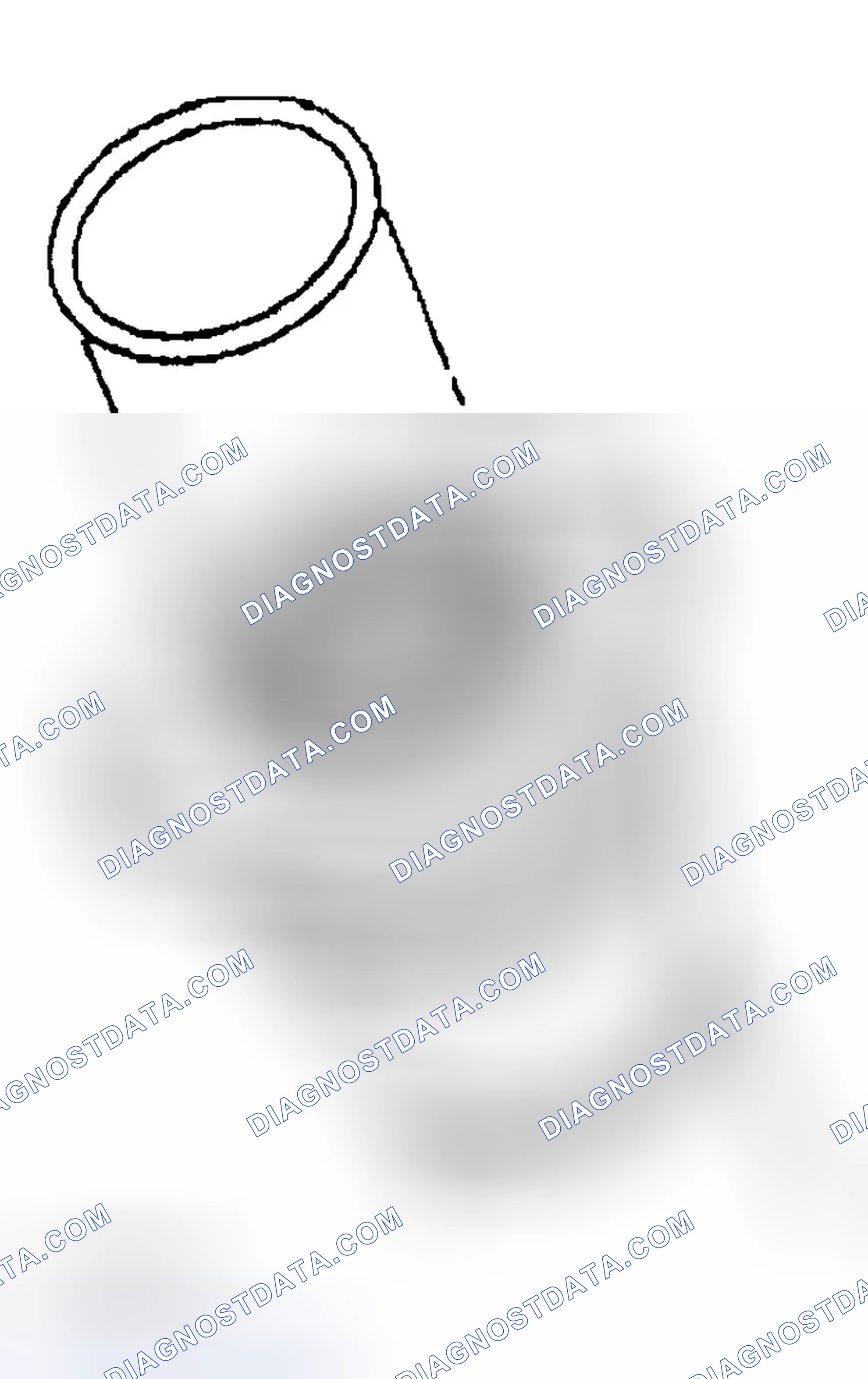 Scheme 19: Installation Procedure