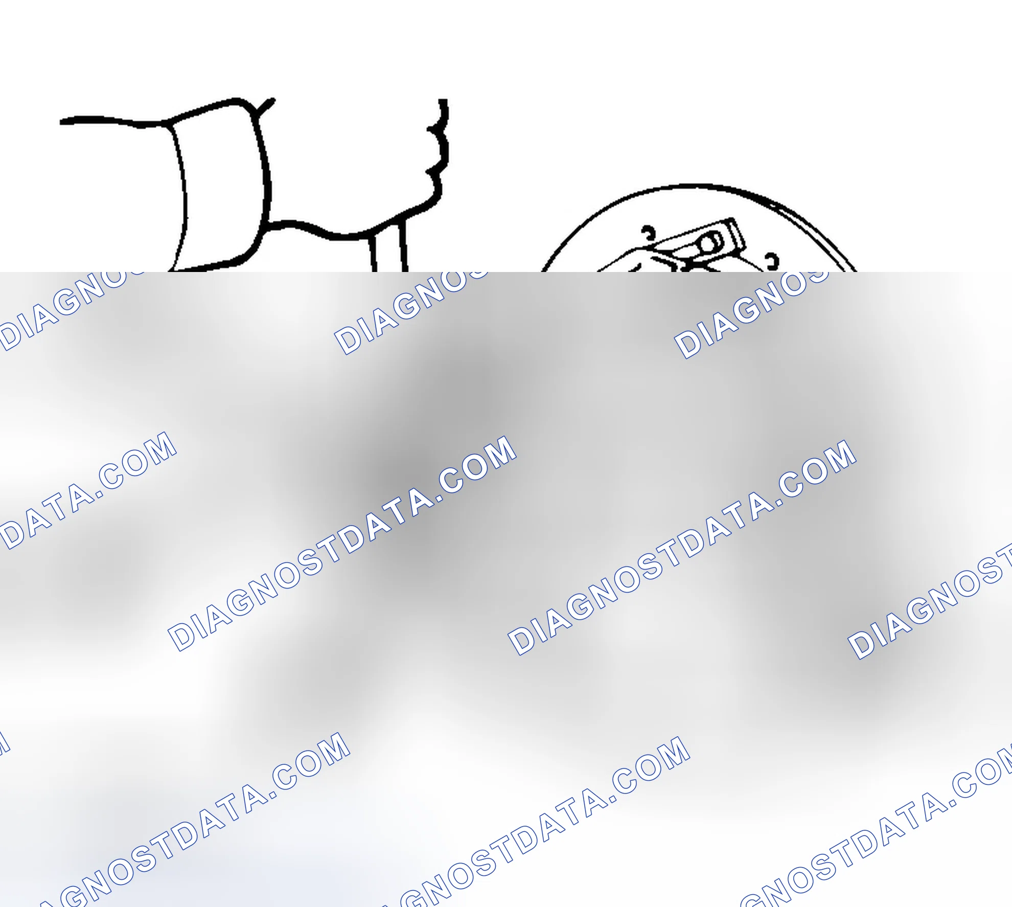 Scheme 76: << D >> SELF-LOCKING NUT REMOVAL