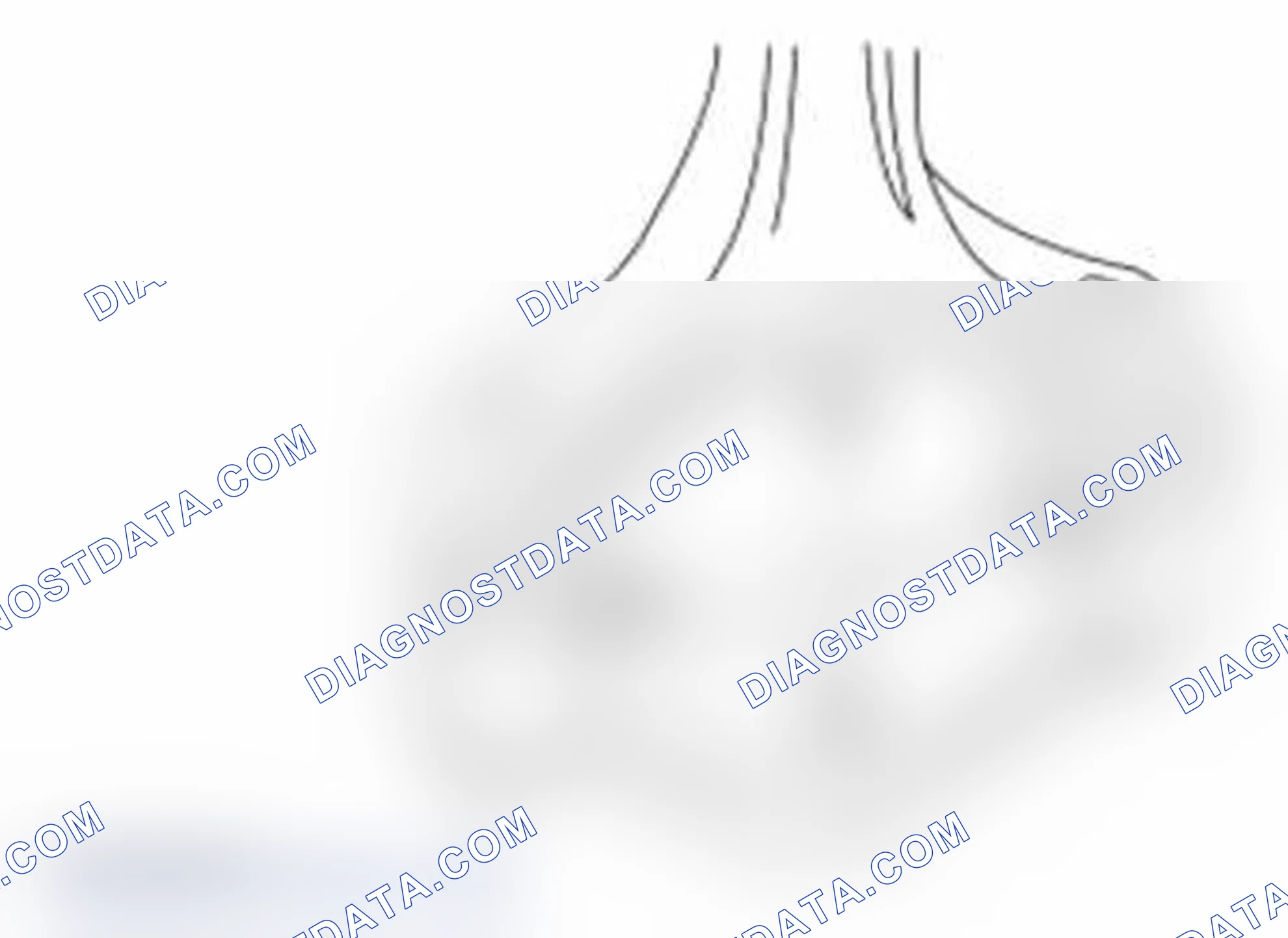 Scheme 1553: Connecting Rod Large End Bore