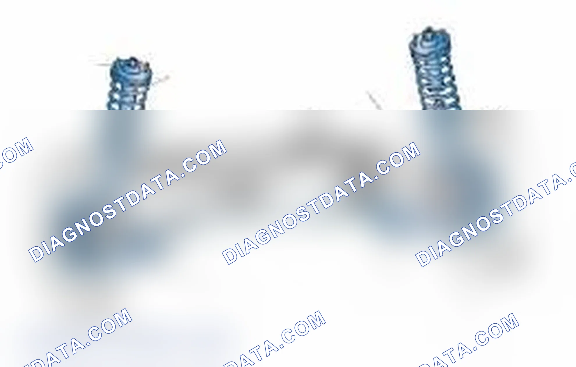Scheme 25: Typical Front Suspension & Steering Components