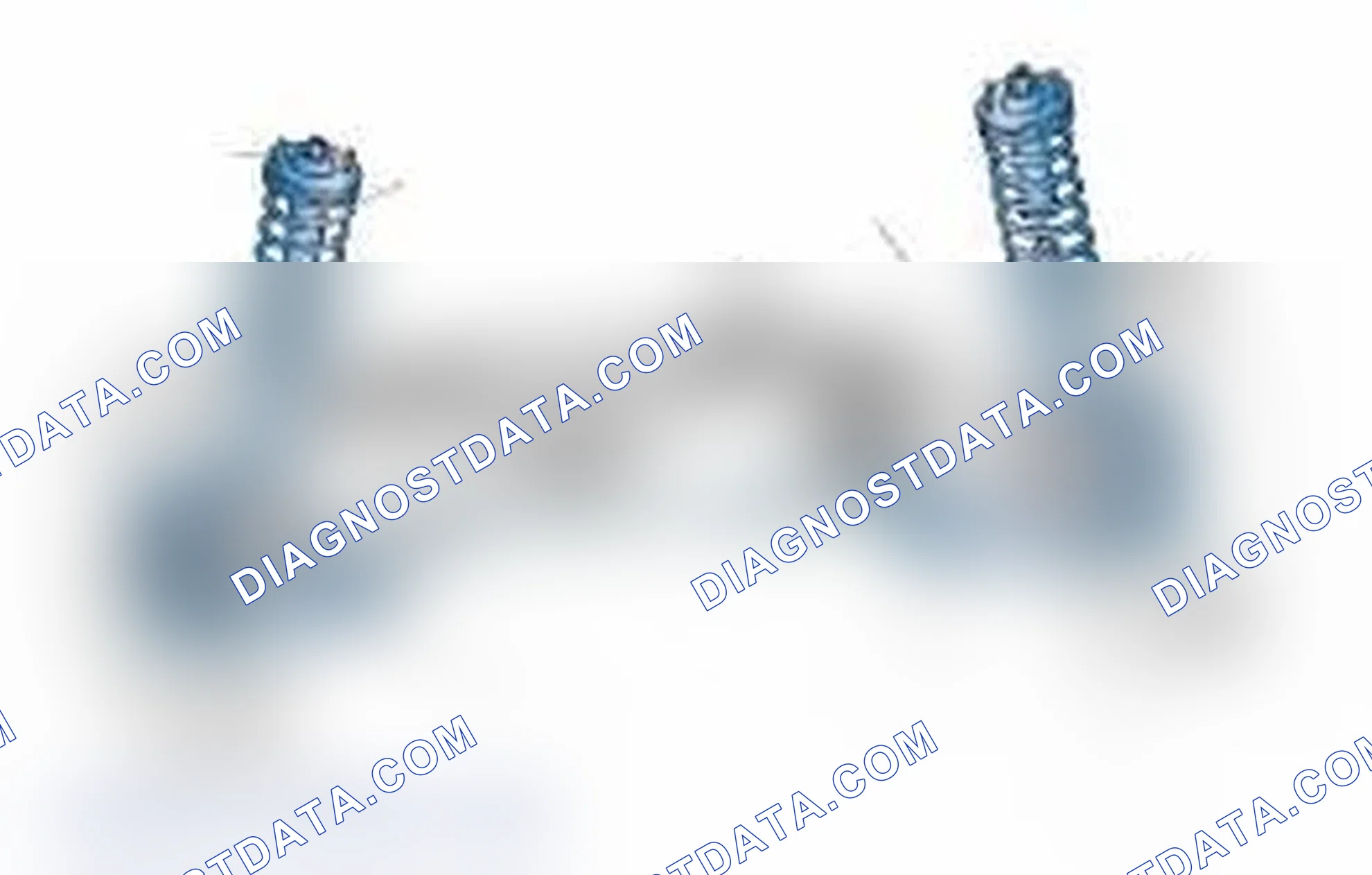 Scheme 25: Typical Front Suspension & Steering Components